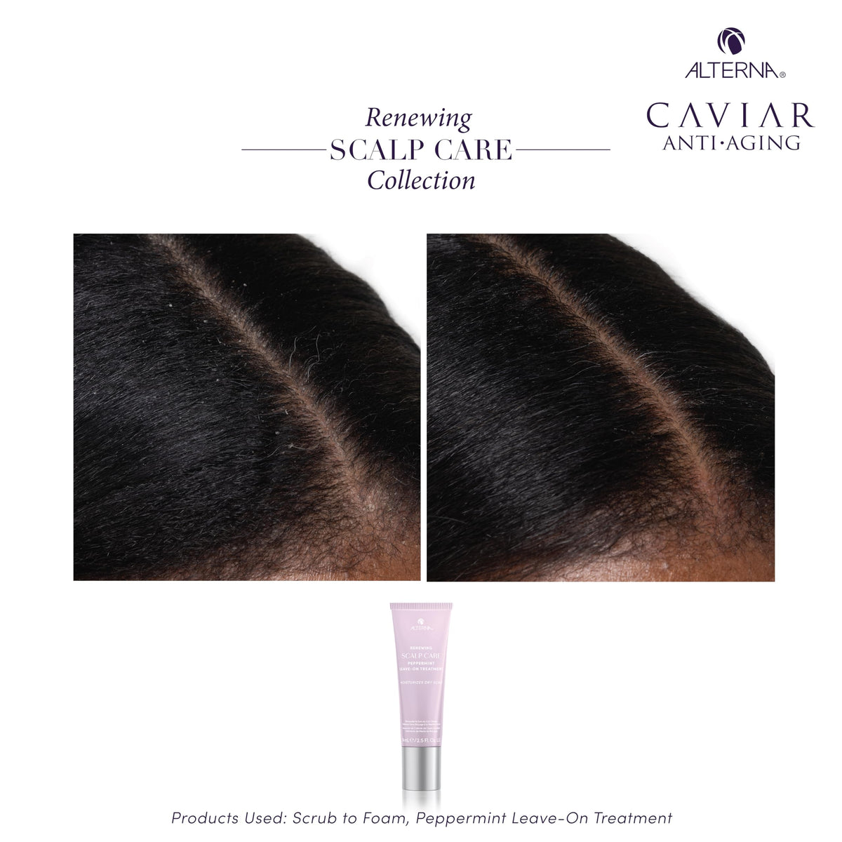Alterna Haircare Renewing Scalp Care Peppermint Leave-On Treatment, 2.5 Fl Oz Lightweight, Fast Absorbing to Moisturize and Invigorate