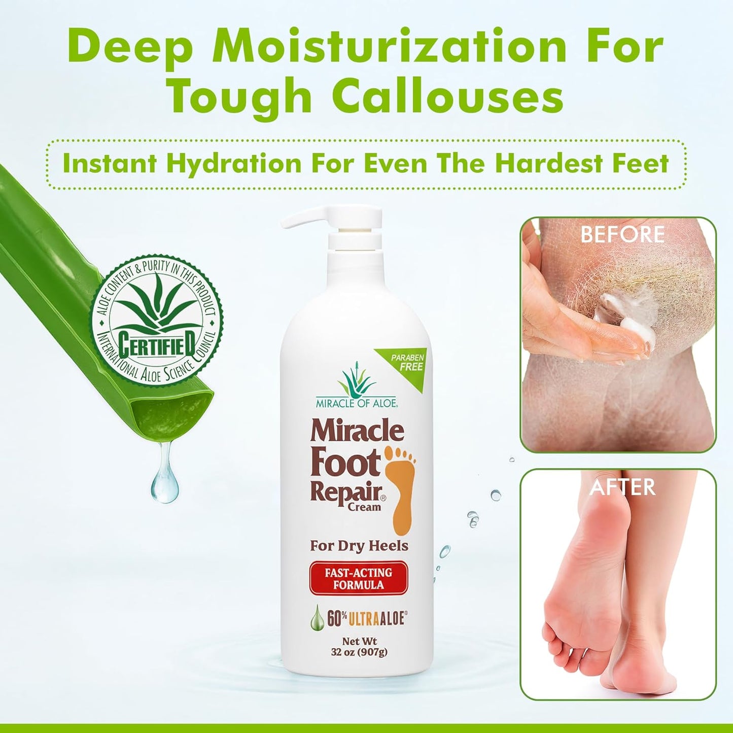 Miracle Foot Repair Cream (1 oz / 12 Pack) Repairs Dry Cracked Heels and Feet, 60% Pure Ultra Aloe Moisturizes, Softens, and Repairs