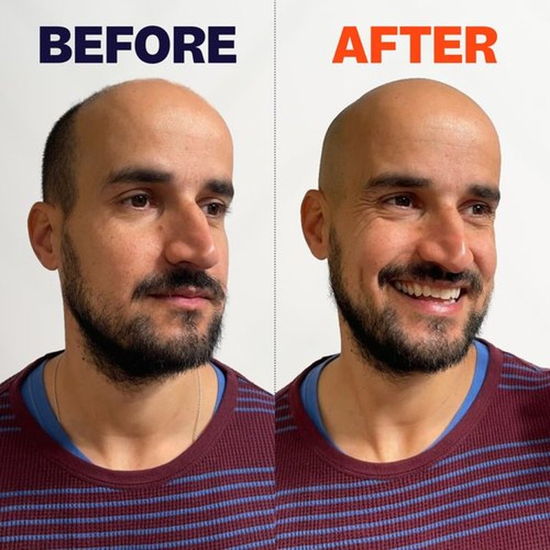 The FlexSeries Electric Head Hair Shaver - Freebird - Ultimate Mens Cordless Rechargeable Wet/Dry Skull & Bald Head Waterproof Razor with Rotary Blades, Clippers, Nose Trimmer, Brush, Massager