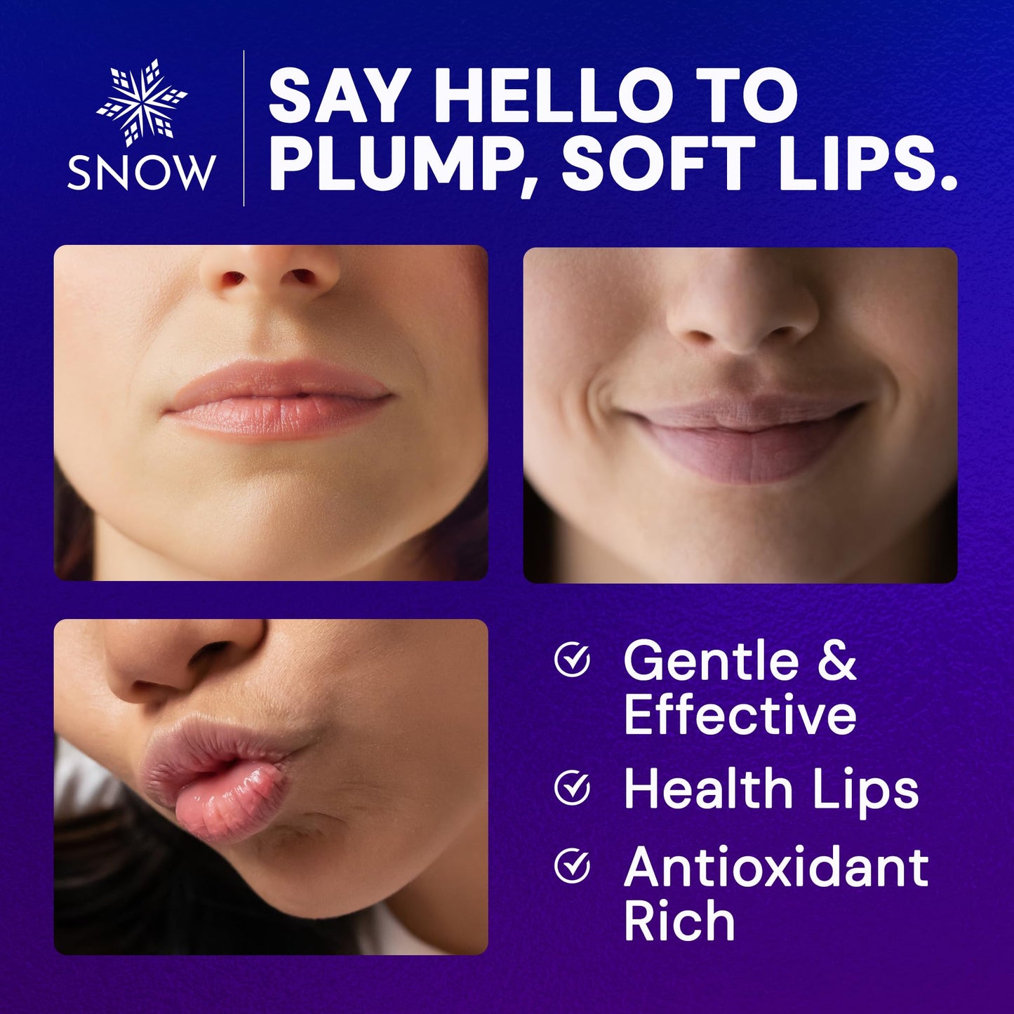 SNOW Overnight Lip Treatment - Moisturizing Lip Balm with Shea Butter & Vitamin E - Lip Treatment for Dry, Cracked Lips - Sulfate-Free Lip Treatment - Plumping & Hydrating Lip Care Mask