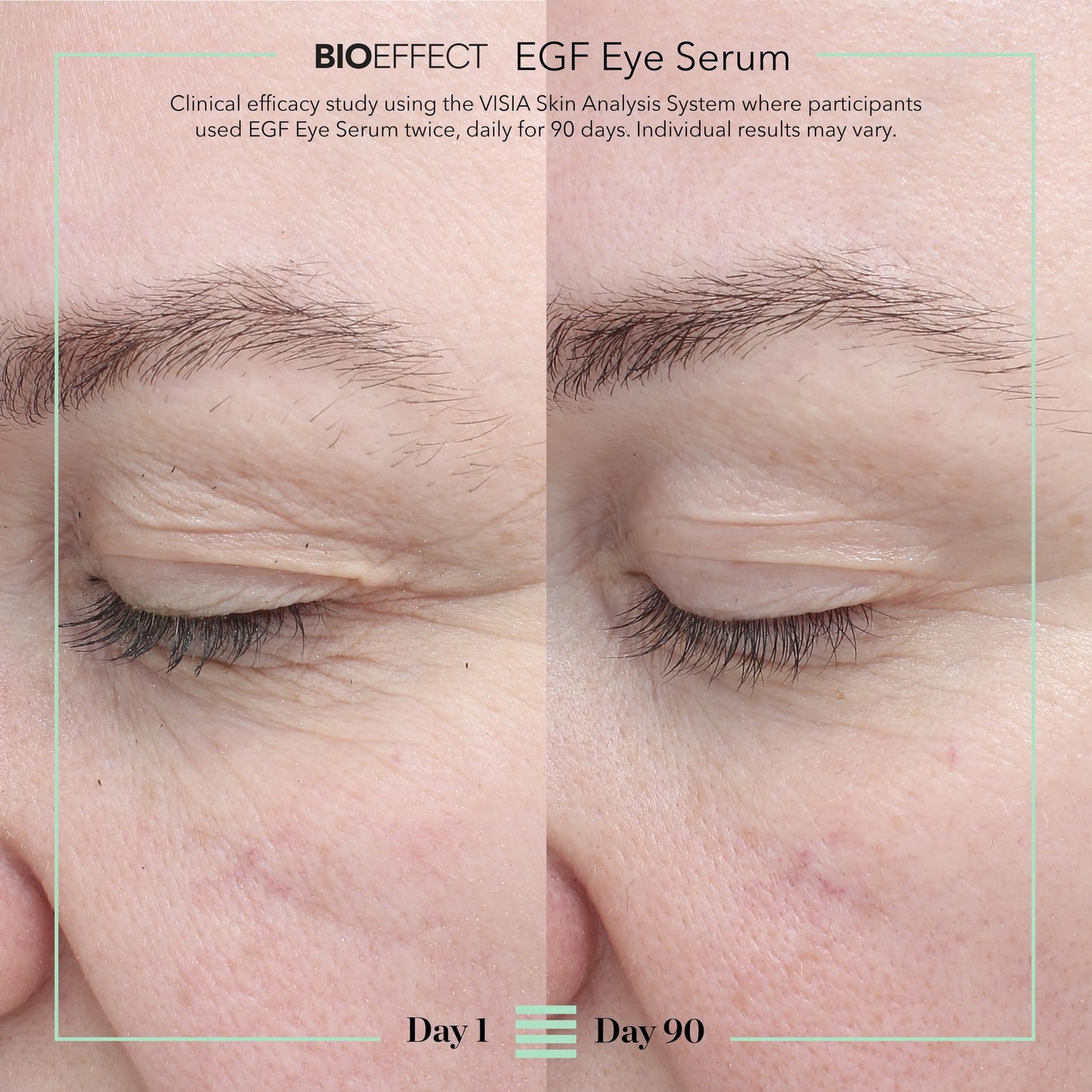 BIOEFFECT EGF Eye Serum with De-Puffer Rollerball | Age-Defying Under Eye Treatment with Epidermal Growth Factor for Fine Lines, Wrinkles, Puffiness & Sagging (6 mL + 6 mL) 12 mL / 0.40 oz