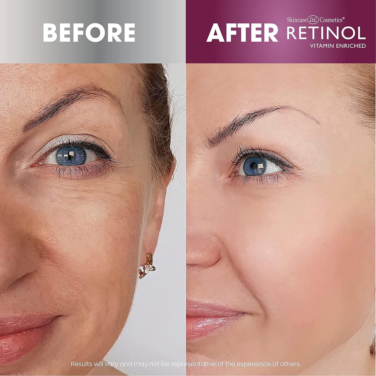 Retinol Anti-Aging Facial Oil – Instantly Adds A Glow To Your Face For A Younger Look – Radiance Booster With Nine Essential Oils Restores Hydration & Nourishment To Your Skin Night & Day