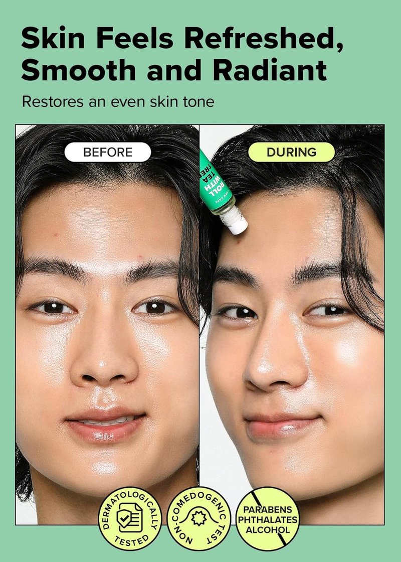 I DEW CARE Roll-On Face Oil - Tea Tree Spot Treatment for Acne & Blemishes | Hydrating Serum, 0.37 FL Oz