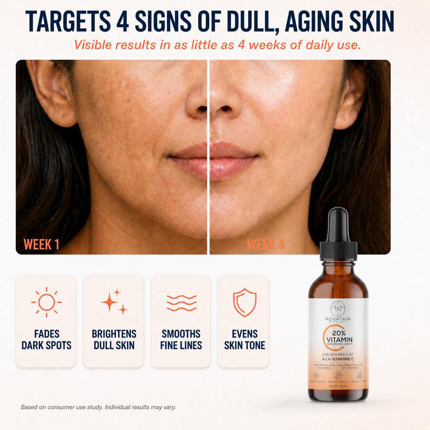 Mountain Fresh Naturals Vitamin C Serum – 20% 3-0-Ethyl Ascorbic Acid, Ferulic Acid & Vitamin E – Brightening, Hydrating, Anti-Aging Serum for Dark Spots, Uneven Skin Tone & Wrinkles – 30mL / 1 fl oz