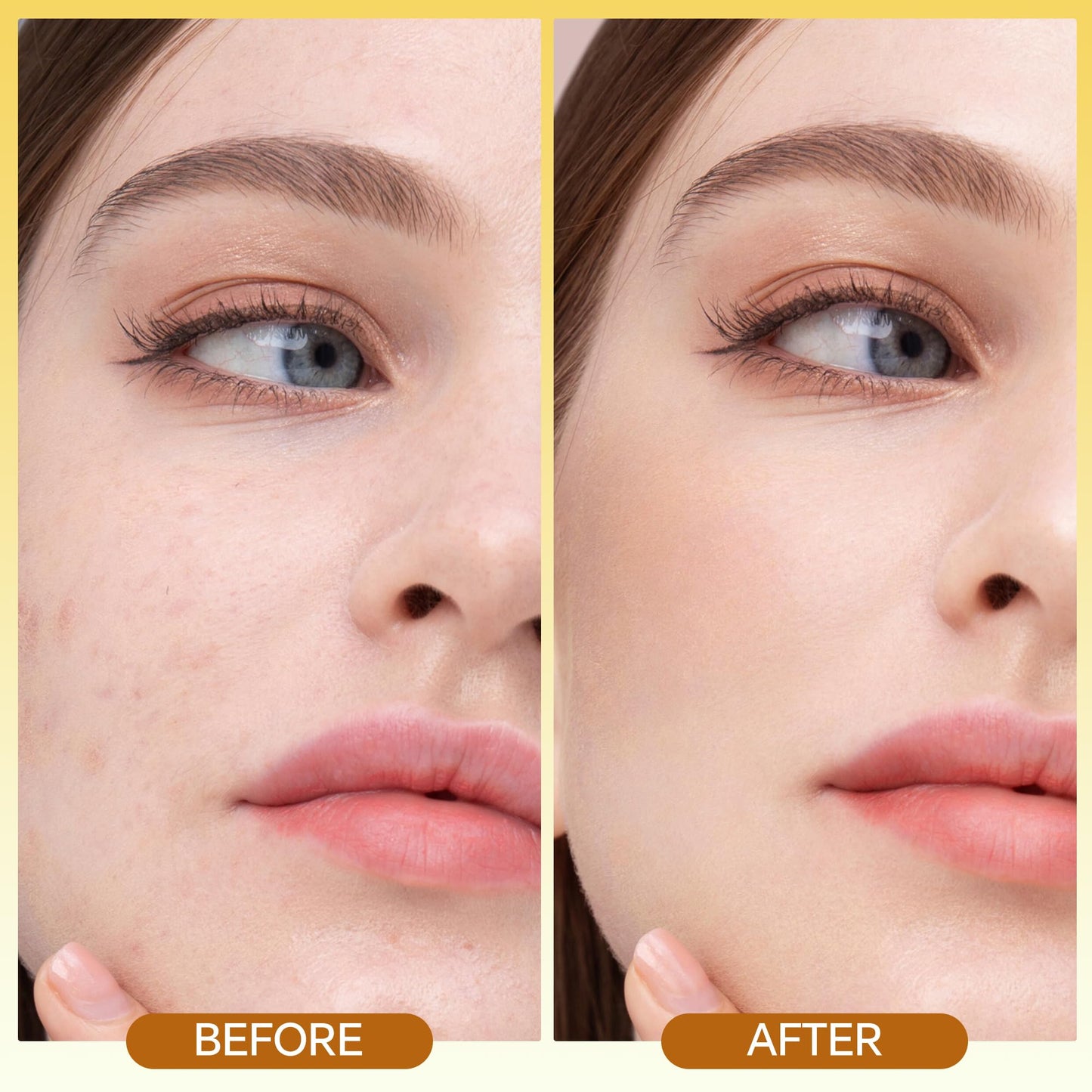 MegustaMe Skin Renewing Vitamin C Serum 30ml - Pure Vitamin C Serum Dermatologist Developed Brightening Antioxidant Face Serum for Glowing Skin,Hydrating Skin Barrier Repair Serum.