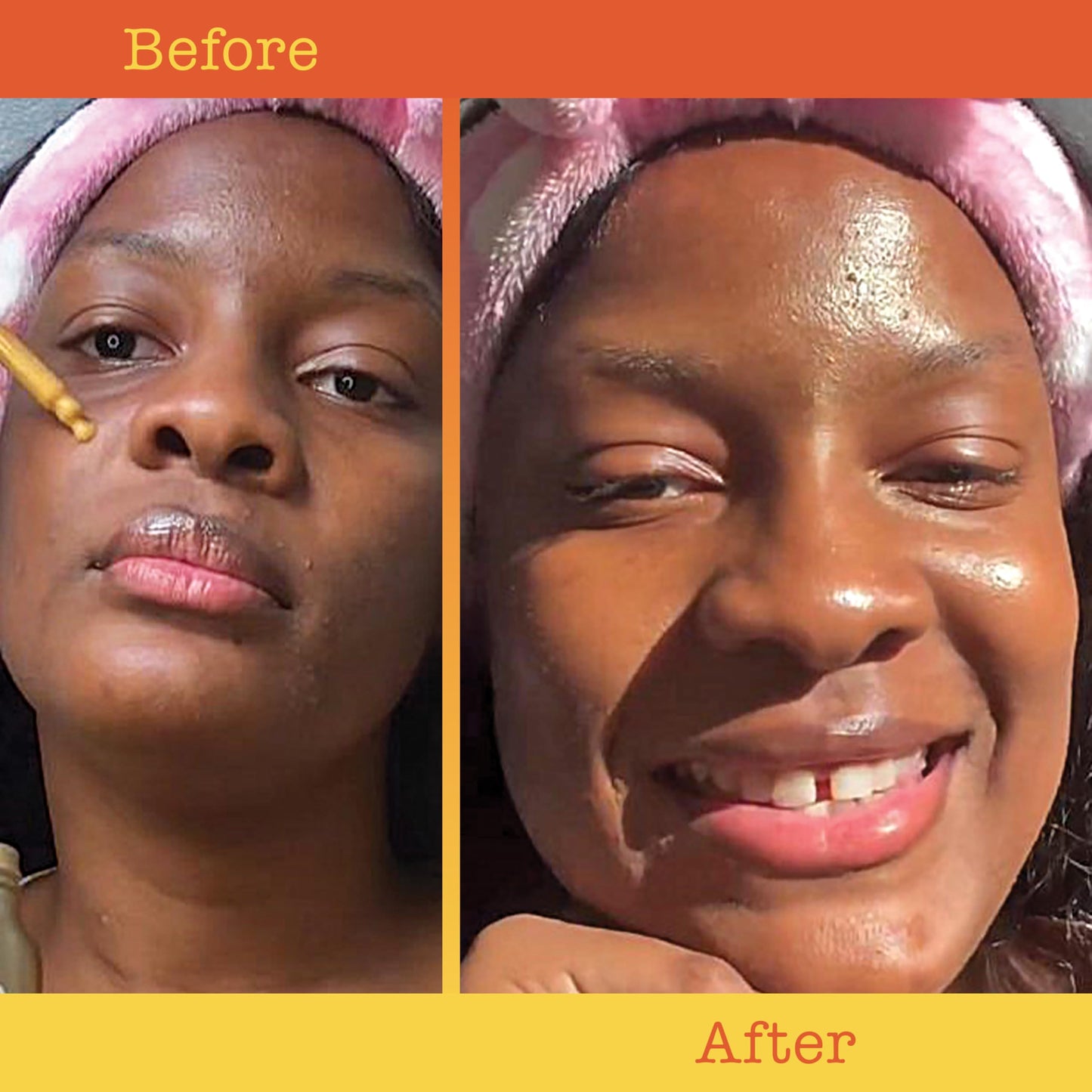 APTO Shimmer Drops w/Turmeric & Niacinamide: Nourishing Serum for a Subtle Sun-Kissed Face or Body Glow, 2 fl. oz.