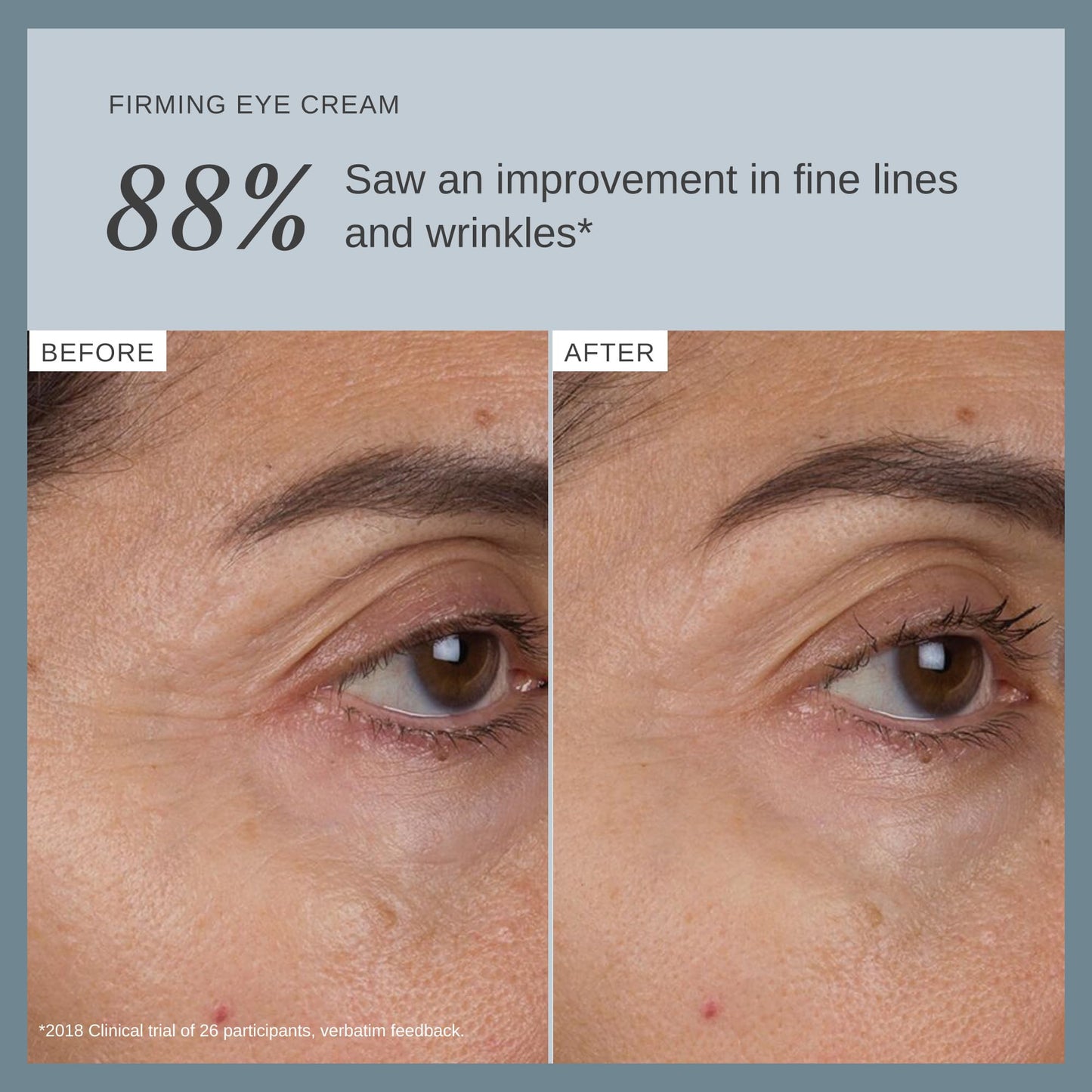 Alpha-H Liquid Gold Firming Eye Cream for Fine Lines & Puffiness (15ml)