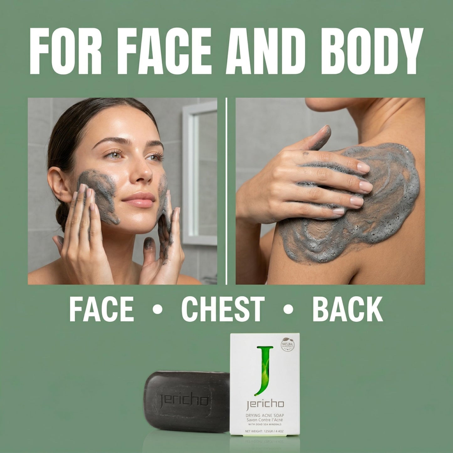 Jericho Acne Drying Bar Soap Face, Chest & Back – Dead Sea Mineral Cleansing Bar, Oily Acne-Prone Skin – Deep Pore Cleanser, Breakouts, Blackheads – Teens & Adults 4.4oz / 125g