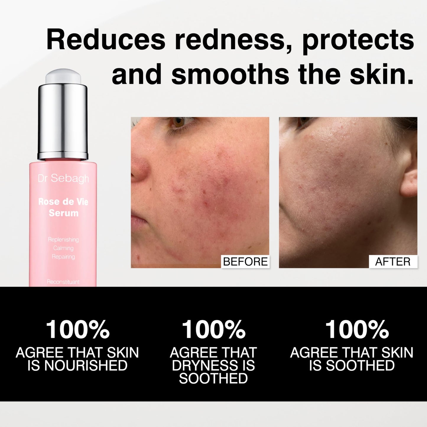 Dr Sebagh Rose de Vie Serum - 1 fl oz - Award-Winning Nourishing Anti-Aging Formula - Use with Dry, Mature, or Sensitive Skin - Designed to Soothe Redness & Irritation - Regenerating & Invigorating