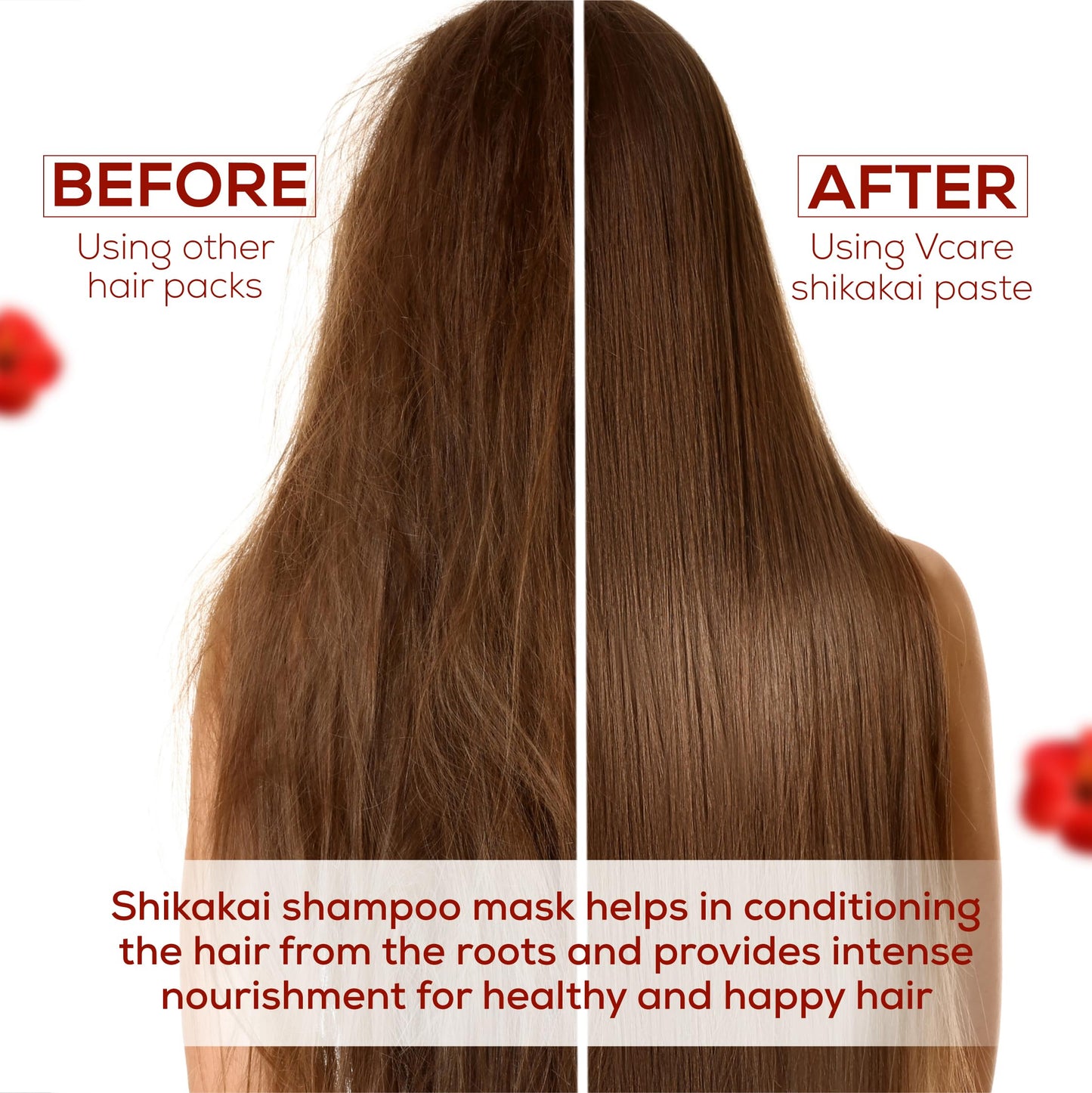 VCare Shikakai Shampoo Enriched With Amla | Hibiscus| Aloevera | Neem -200ml/6.7 Fl Oz