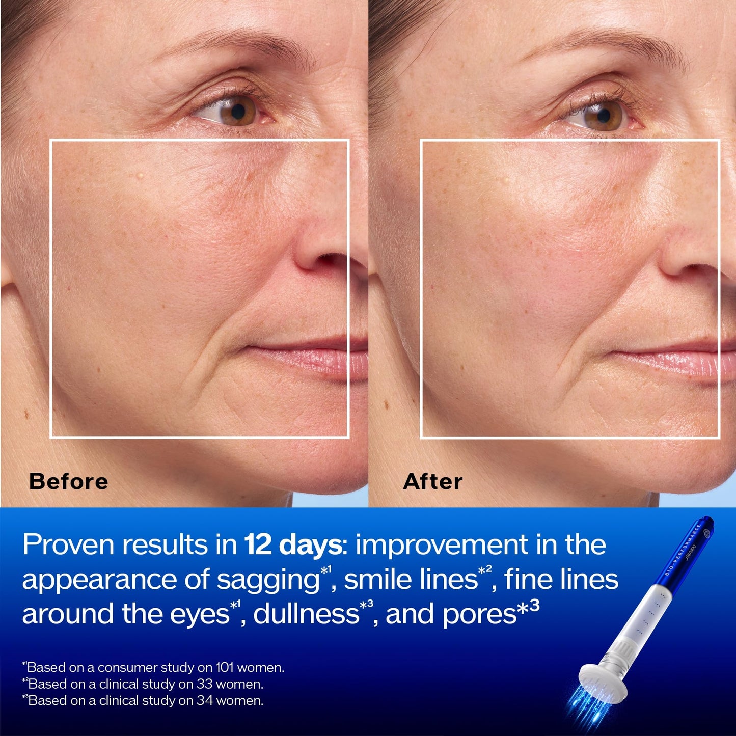 Shiseido Bio-Performance Micro-Click Concentrate - Next-Generation Targeted Serum for Wrinkles - 1.4 mL (6 Applications) - All Skin Types
