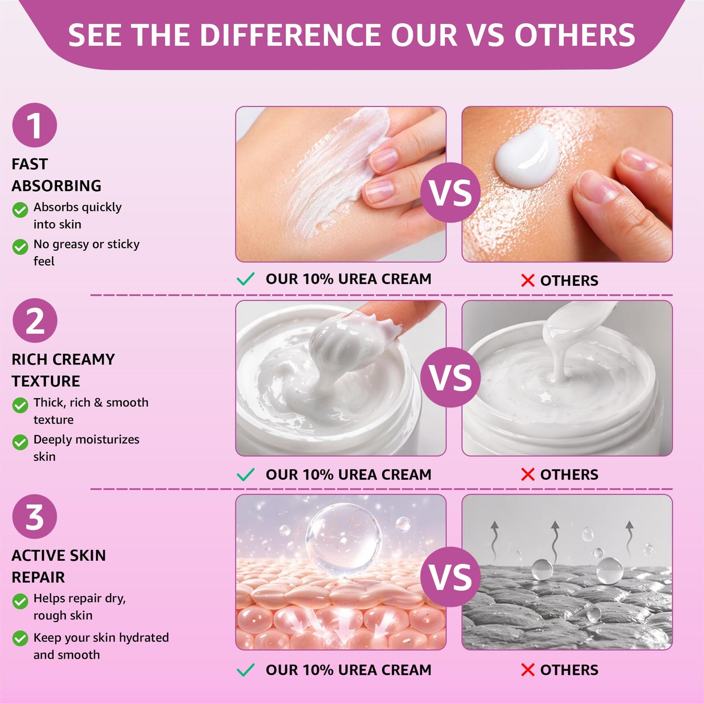UREA LABS 10% Urea Cream with Aloe Vera, Jojoba Oil and Salicylic Acid - 150ml Hydrating Moisturizer for Dry, Chapped Hands, Feet, Face & Body - Repairs, Soothes & Nourishes Rough, Dry Skin - 4 Oz