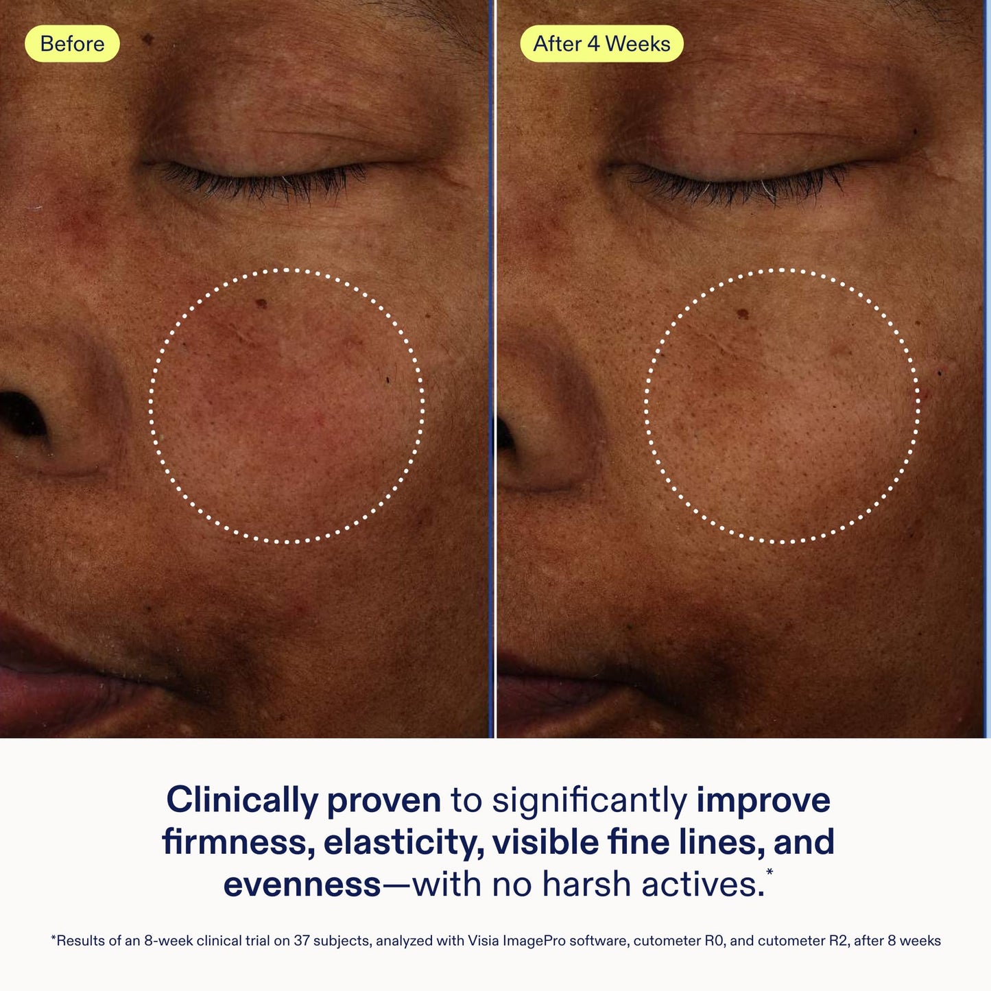 Skinfix Exo + Ectoin Intensive Repair Baume - 1 oz - Retinol-Free Face Serum with Hyaluronic Acid, Peptides - Visibly Smooths Wrinkles, Evens Dark Spots & Redness - Fragrance Free, Vegan, Cruelty Free