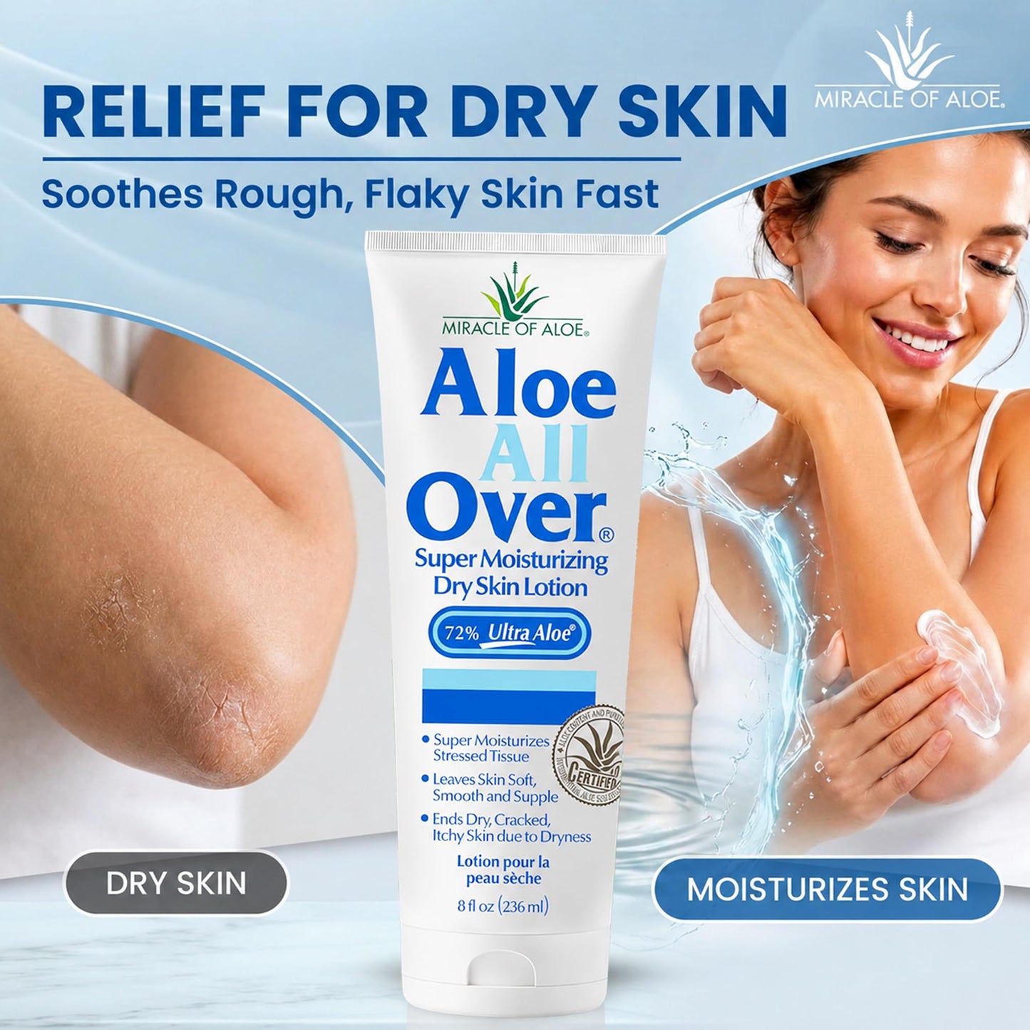 Aloe All Over Super Moisturizing Dry Skin Lotion, 3-Pack, 8 oz, 72% Aloe Vera Gel. Safe for Everyone, Ends Flaking and Restores Dry Skin Fast