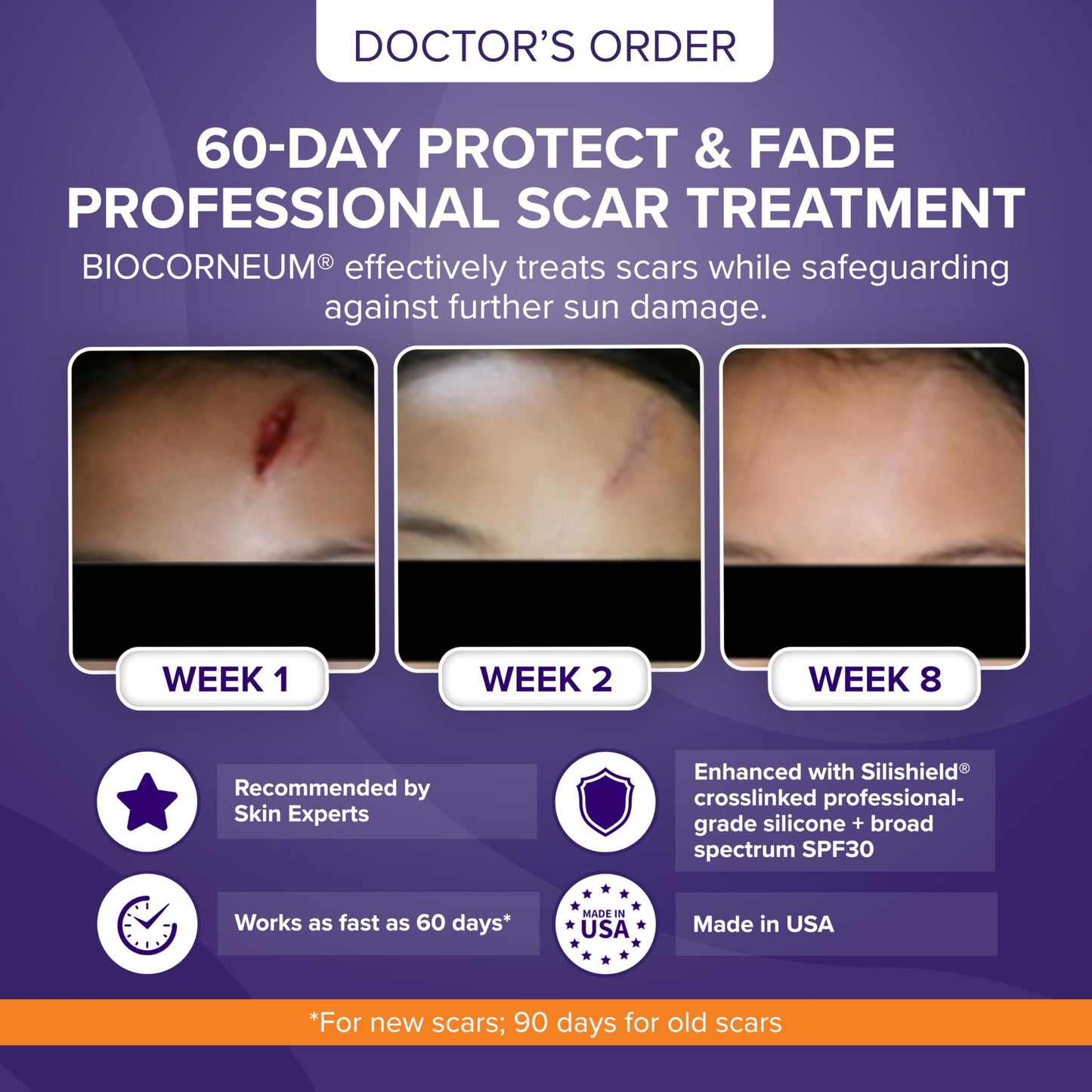 Biocorneum Advanced Scar Treatment – Silicone Scar Gel with SPF 30 & Silishield® 20g – Scar Cream for Surgical Scars, C-Section & Acne – Fast Drying, Water Resistant Scar Removal Gel for Children