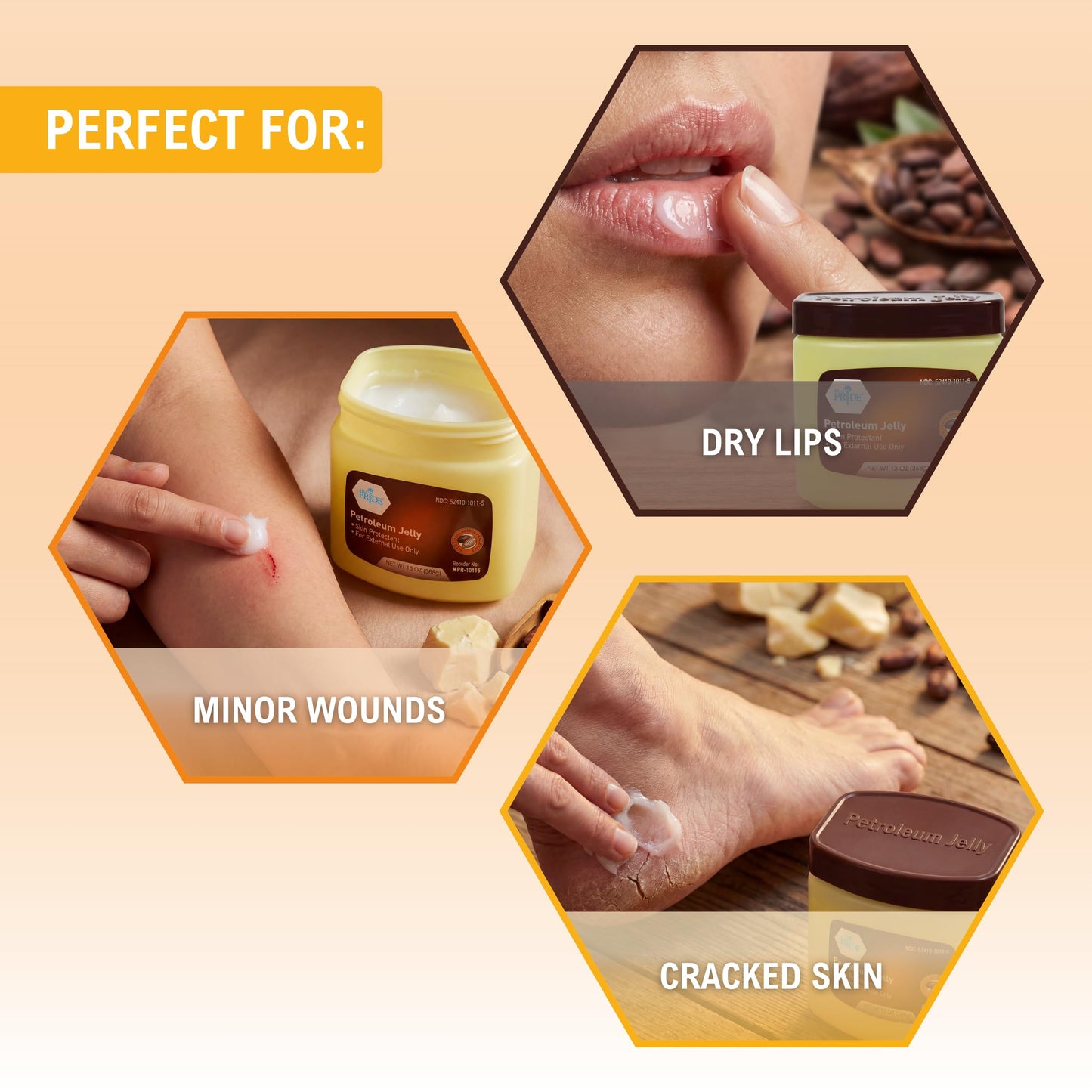 MED PRIDE Cocoa Butter Petroleum Jelly, 13 oz - Moisturizing Skin Protectant for Dry Skin, Cracked Hands, Chapped Lips, Rough Heels & Minor Cuts - Hypoallergenic Cocoa Scented Ointment