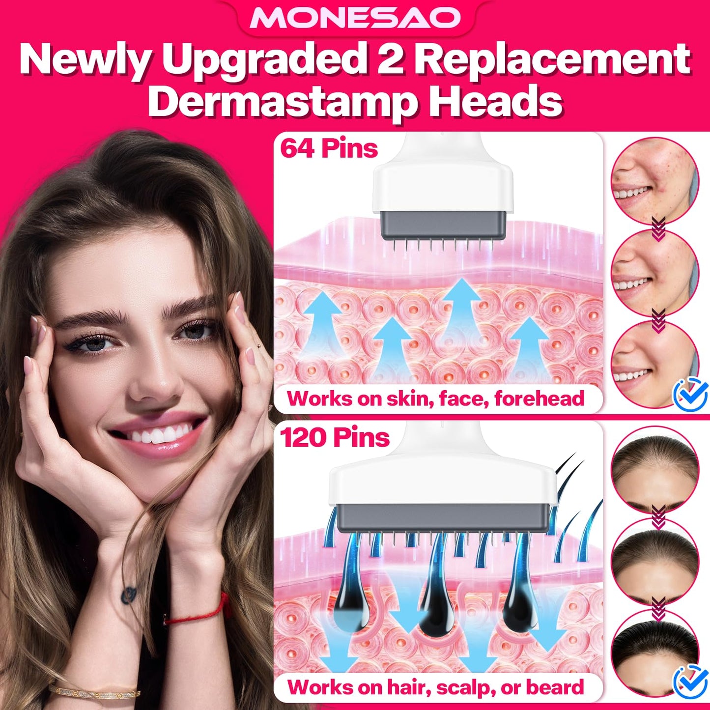 Derma Stamp, MONESAO Microneedling Stamp for Skin Face Hair Scalp Beard, Microneedle Dermastamp Tool with 2 Replacement Heads, Micro Needling Stamp Kit for Women and Men