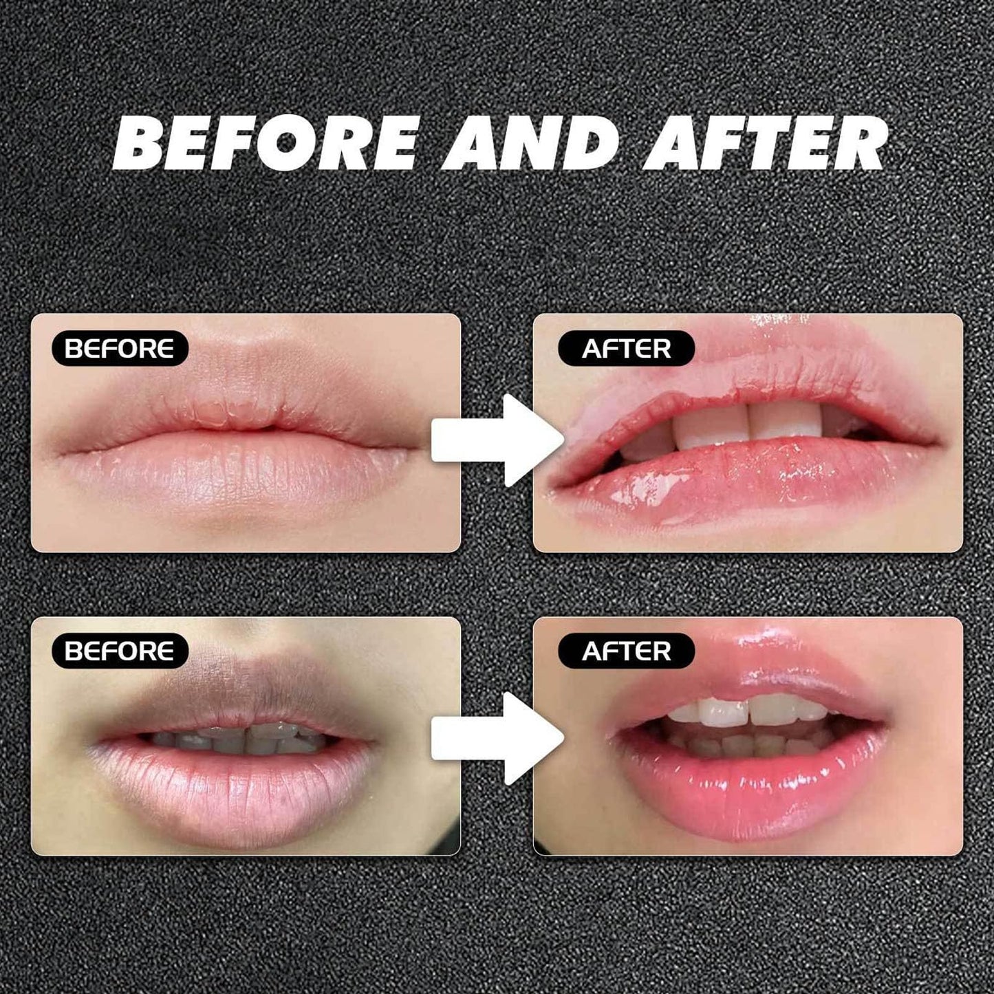 INSEEK Lightening Lip Balm for Dark Lips, 2Pcs Lip Lightening Balm for Smokers, Long-Lasting Hydration to Soften Dry Cracked Dull Looking Lips, Gentle Exfoliating Care to Smooth Dry, Flaky Texture