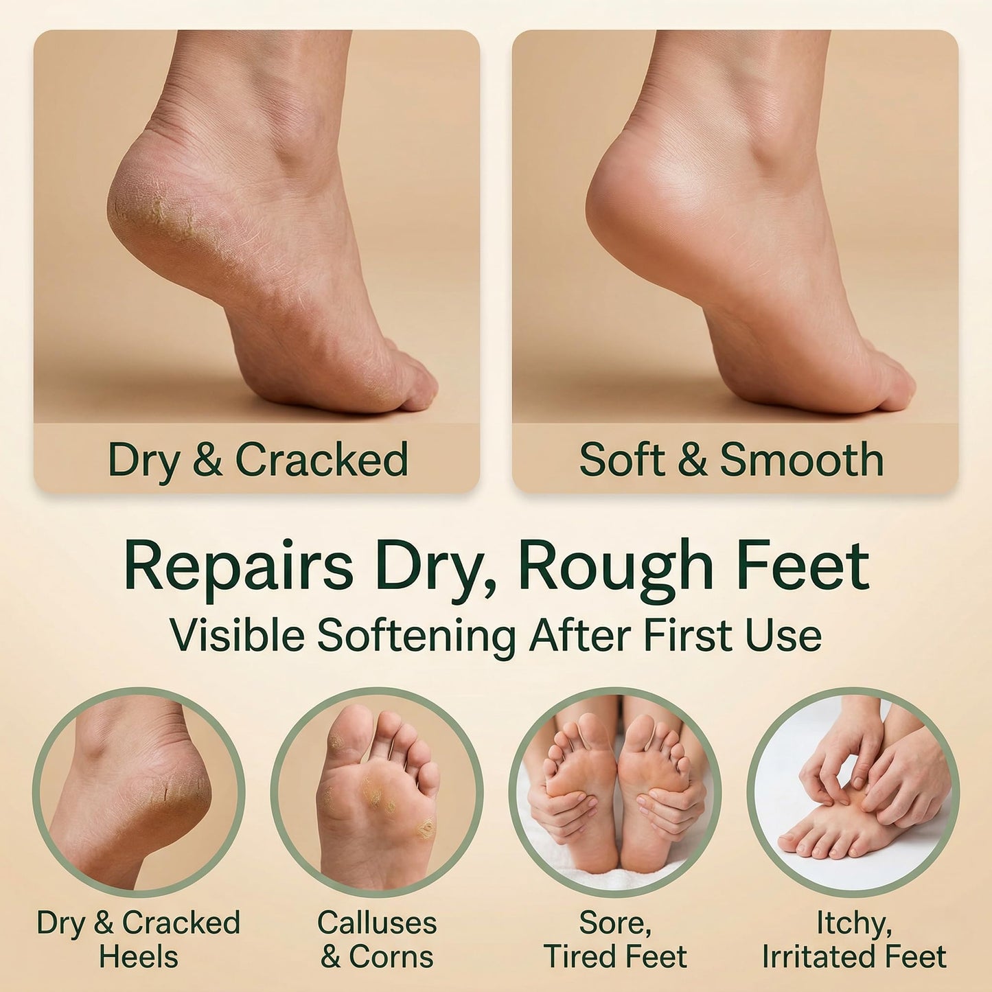 Natural Escapes Peppermint Foot Cream for Dry Feet & Cracked Heels, 8 oz