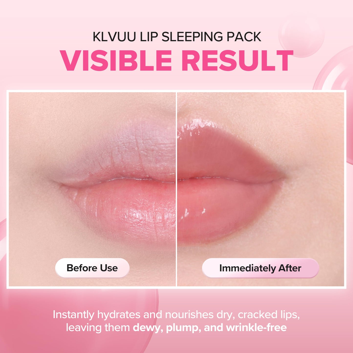 Klavuu Lip Mask Overnight (0.7oz) - Lip Moisturizer & Treatment for Very Dry, Lip Sleeping Mask, Chapped Lips, Korean Deep Hydrating Lip Balm with Melon, Gentle Exfoliating