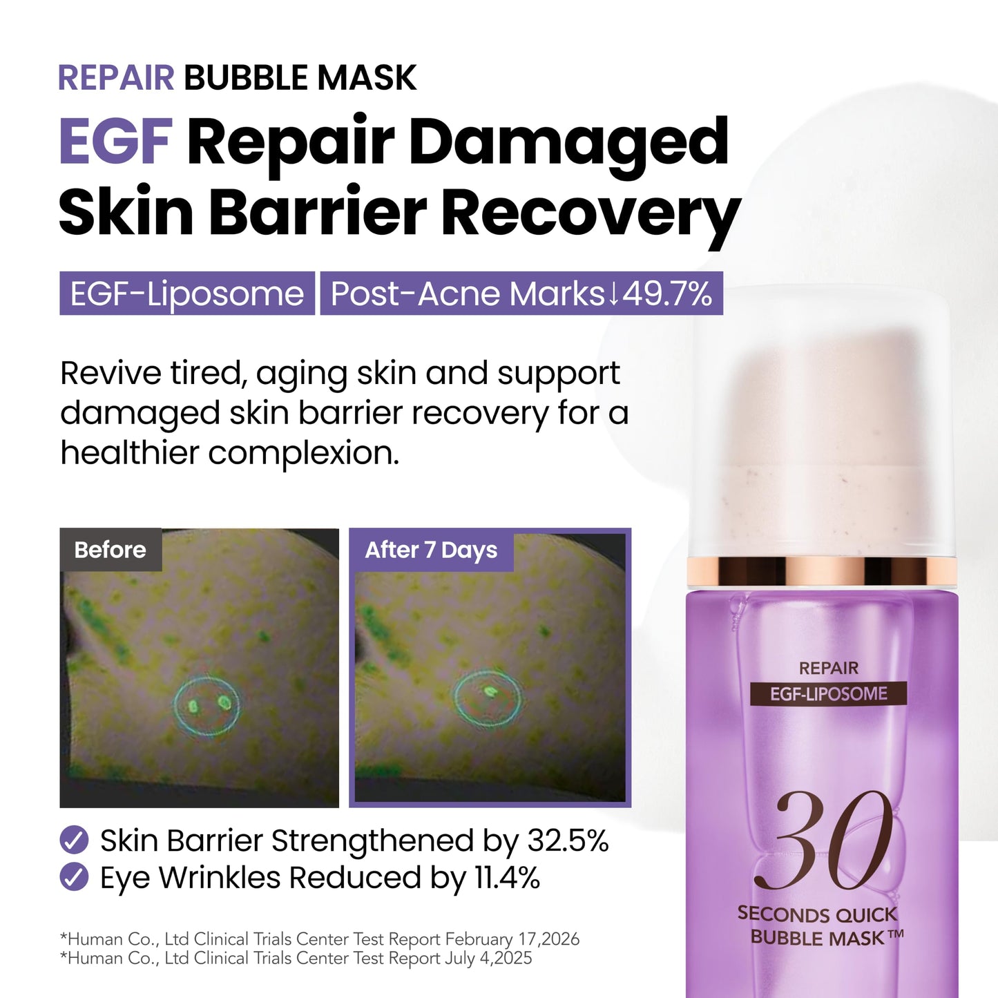 MENOKIN Glass Skin Full Set (5-in-1) 30 Seconds Quick Bubble Mask (Lift, Bright, Clear, Moisture, Repair) Firming, Brightening, Soothing, Moisturizing, Anti-Aging, Korean Face Mask, 3.21 fl oz Each