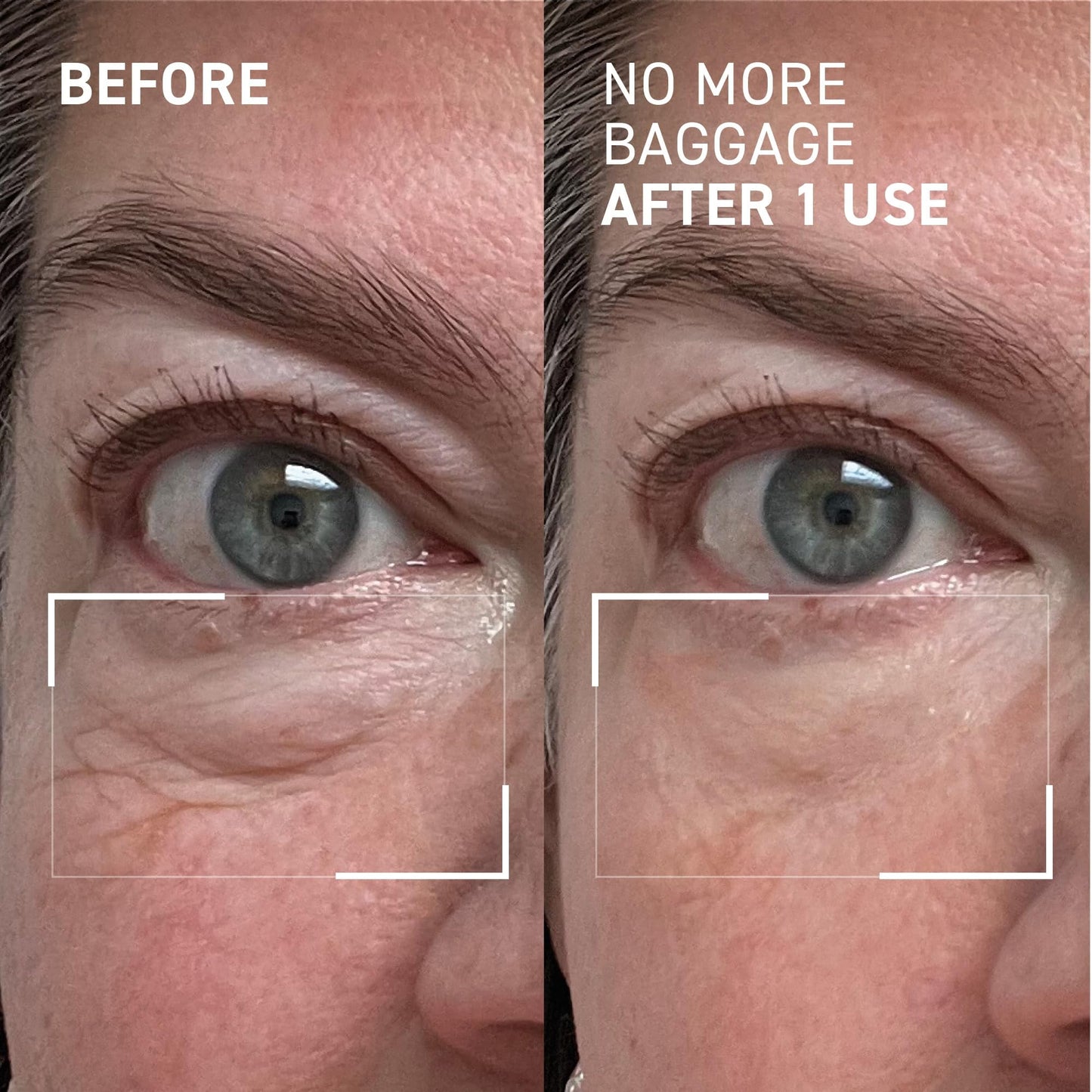Dr. Brandt Needles No More, No More Baggage - 0.5 oz, Pack of 2 - Minimizes Under-Eye Bags, Puffiness & Dark Circles