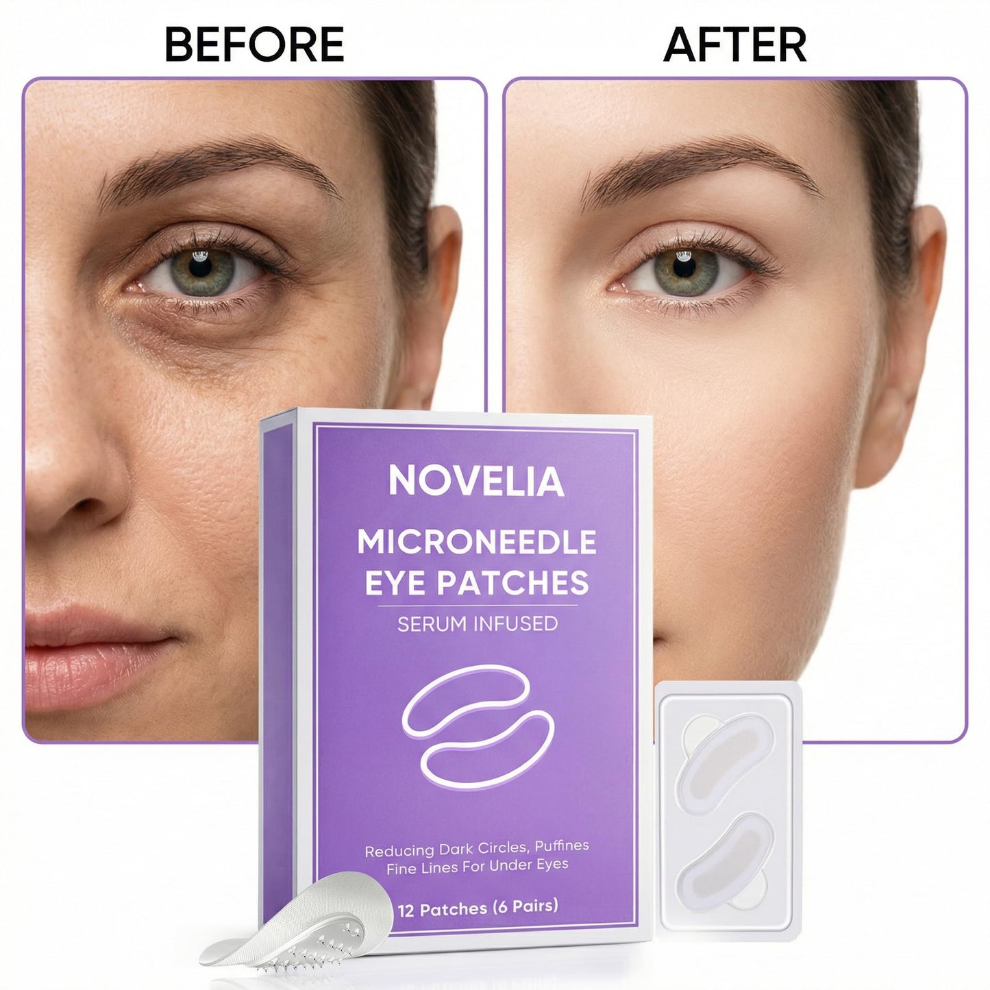 TAWODIUM Novelia Micro Eye Patches, Microglow Undereye Patches, Hyaluronic Acid Serum Infused Eye Masks, Reduce Puffy and Dark Circles, Firming Smile Line, Hydrating & Smoothing Skin (6Pairs) (1 Box)