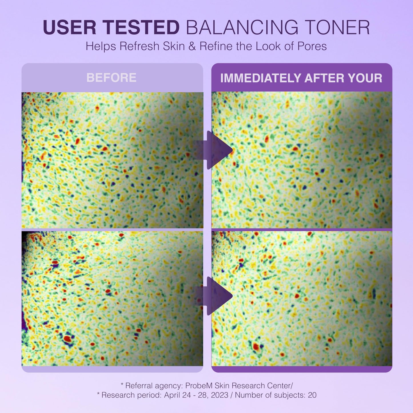 Be-Hope Smoothing Toner | Triple Hyaluronic Acid + Purple Tea | Dry Skin