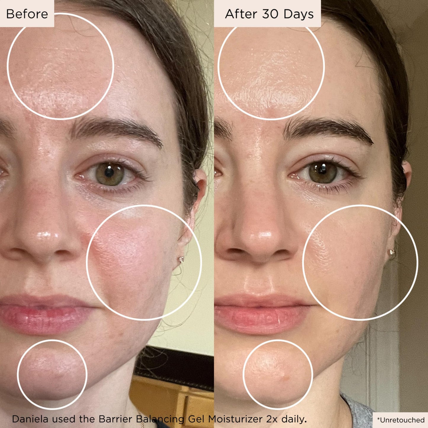 Medature Barrier Balancing Gel Moisturizer, For Combination to Oily Skin, Balances Skin Barrier, Contains Squalane, Sarcosine, Niacinamide & Olive Leaf Extract
