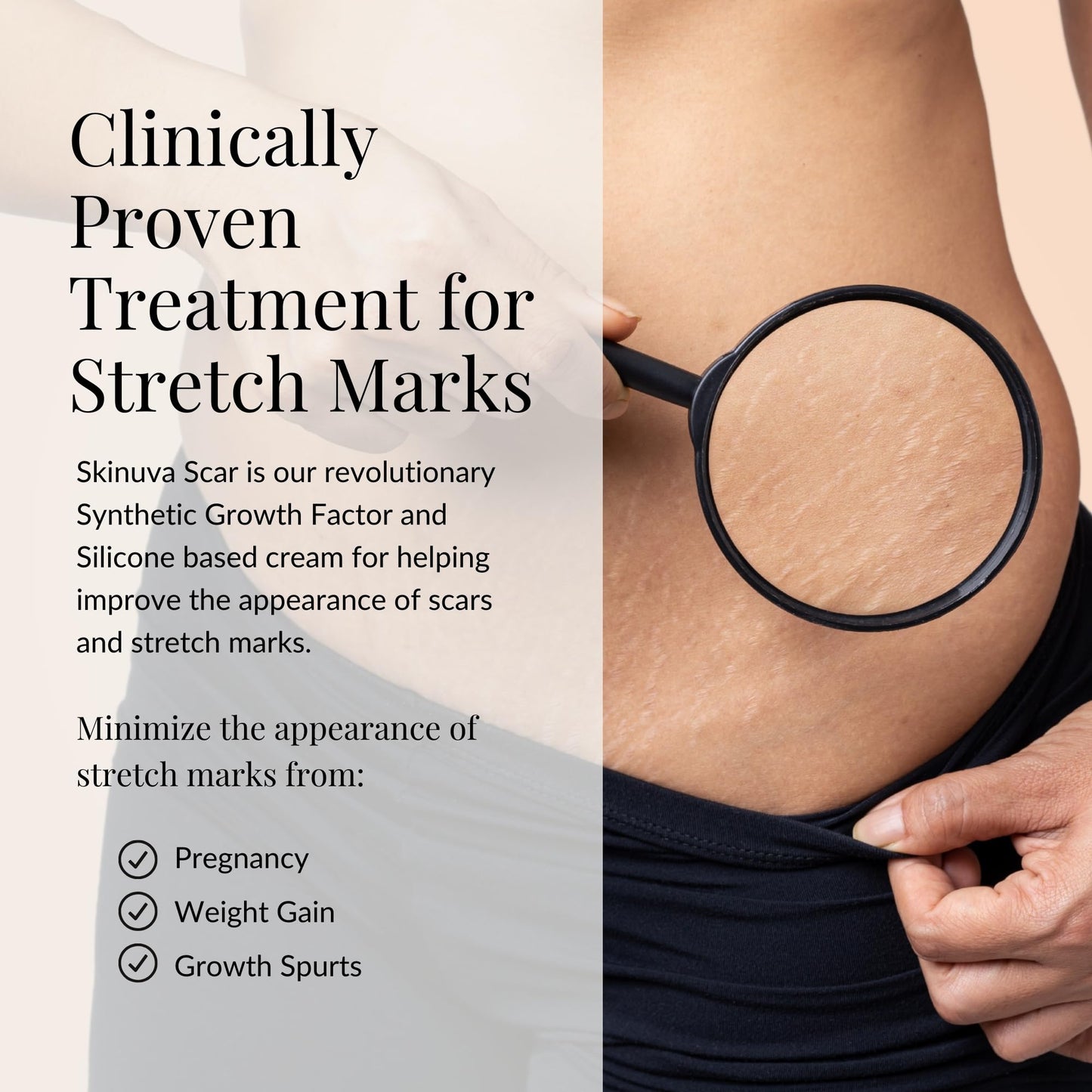 Skinuva® Stretch Mark Cream (2.5 oz)