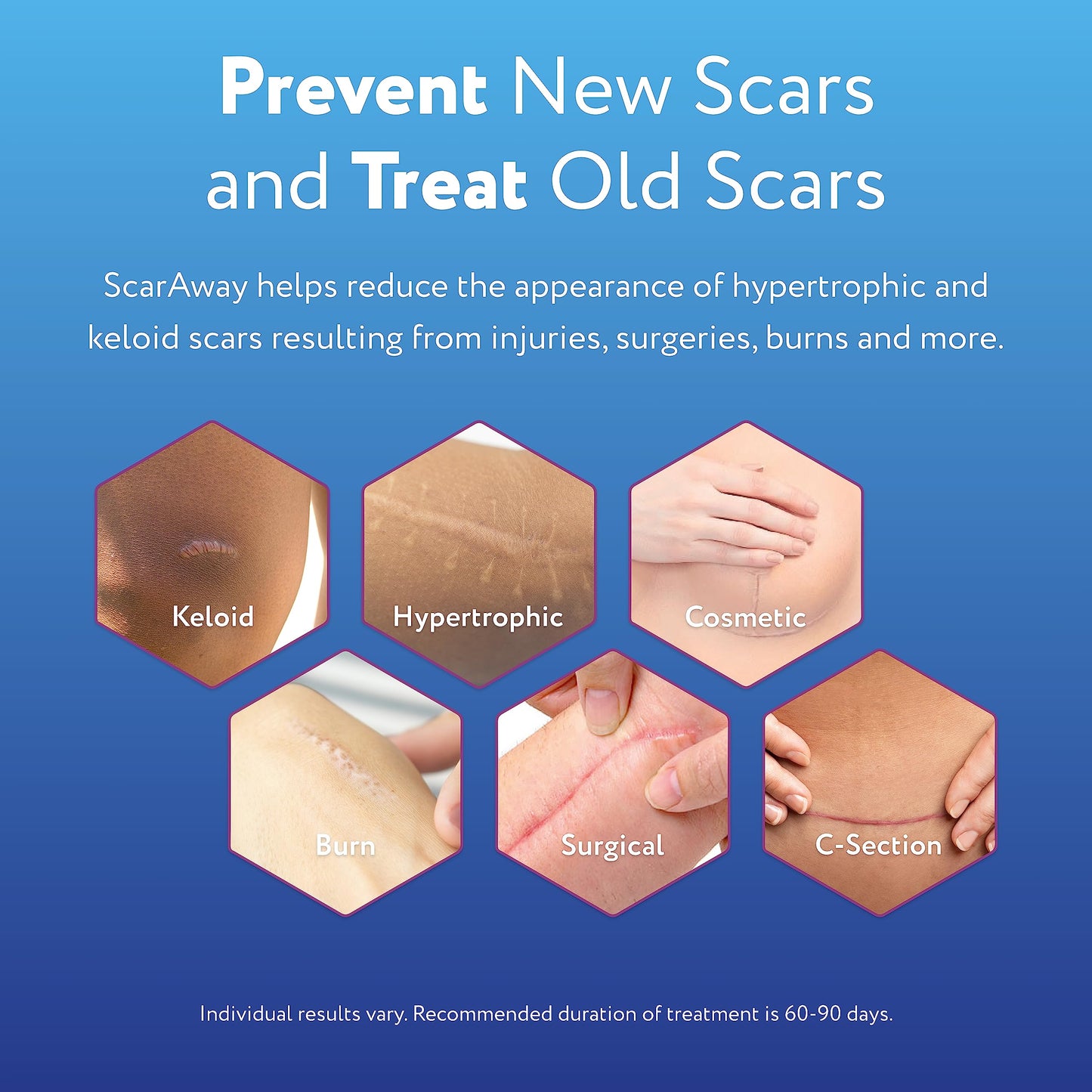 ScarAway 100% Medical-Grade Silicone Scar Gel for Face, Body, Surgical, Burn, Hypertrophic, Keloids and Acne Scar Treatment, 0.71 Ounces, (20 Grams)