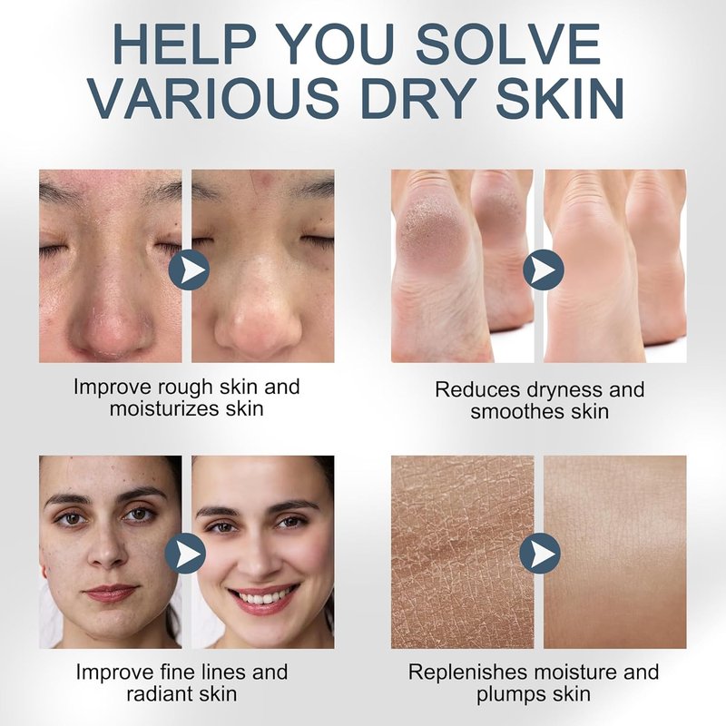 Hyaluronic Acid Powder - DIY Hydrating Serum for Skin | 33 oz, Non-GMO, Low & High Molecular Weight