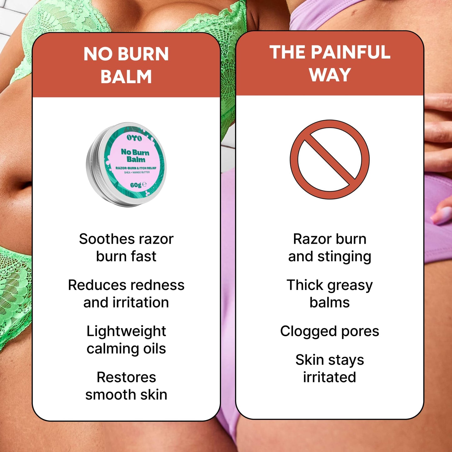 No Burn Balm by OYO – Razor Burn Relief Balm for Bikini Line, Underarms & Intimate Areas, 100% Natural, Fragrance-Free Soothing Formula with Shea Butter, Calendula & Mango Butter, 60 g
