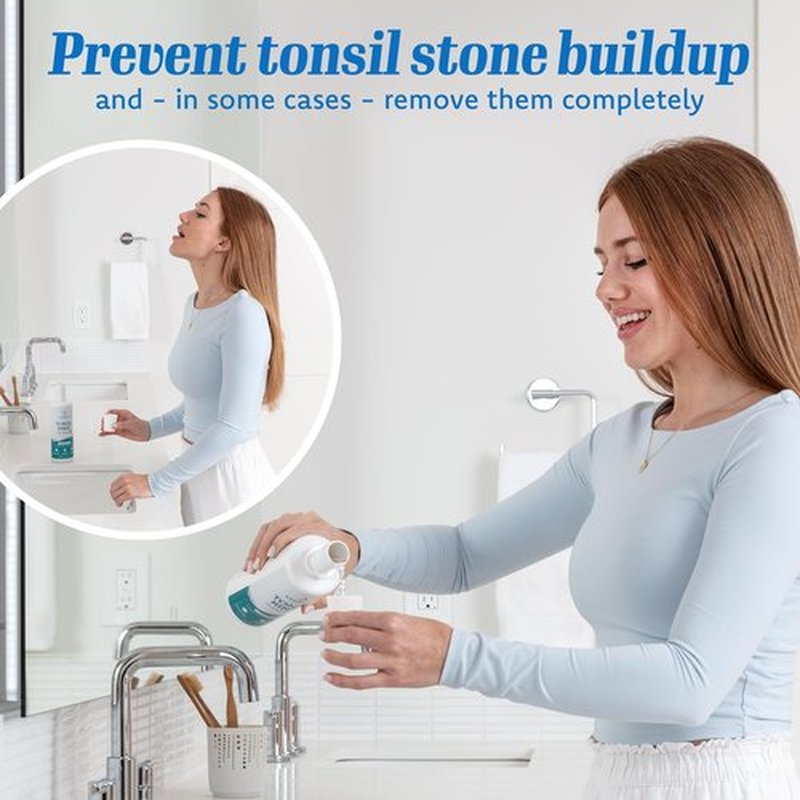 Everest Mouth Wash & Tonsil Stone Remover – Natural Mouthwash or Oral Rinse Liquid to Help Soothe Tonsils, Fight Bad Breath, & Relieve Dry Mouth – Paraben & Alcohol Free Treatment, Spearmint