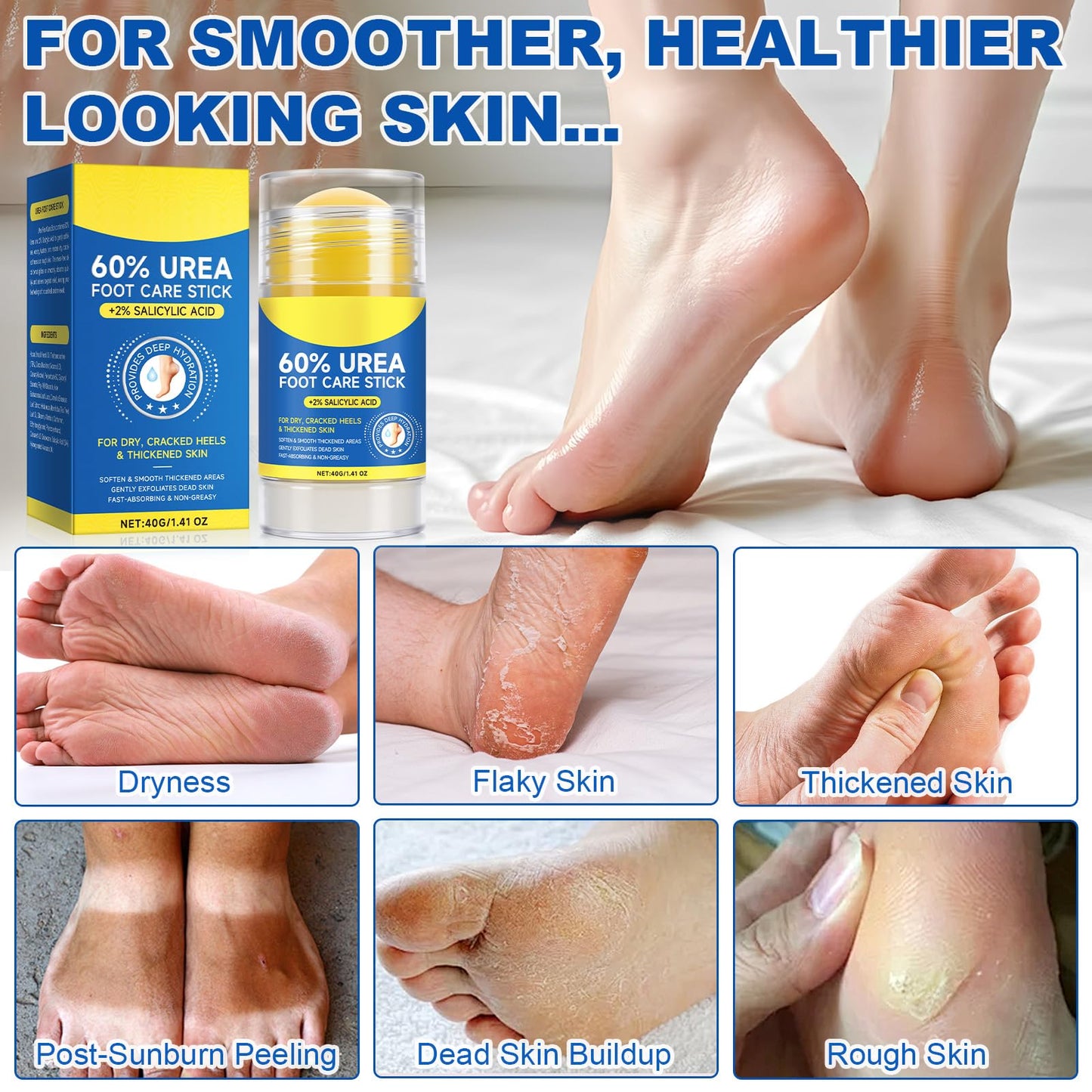 FANSHI Urea Stick 60% High Potency, Foot Care Urea Stick for Deeply Moisturizing & Fast Absorbing, Exfoliation for Dry Cracked Heels & Thickened Skin