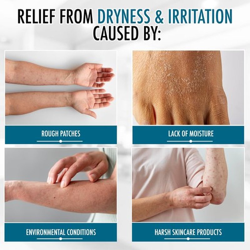 GLY MIRACLE Moisturizing Body Cream for Extremely Dry Skin, Non- Greasy Skin Humectant for Hands, Body & Feet, Body Lotion for Extremely Dry Skin, Non-Oily, with Pure Glycerin, Fresh Scent 12 Ounce