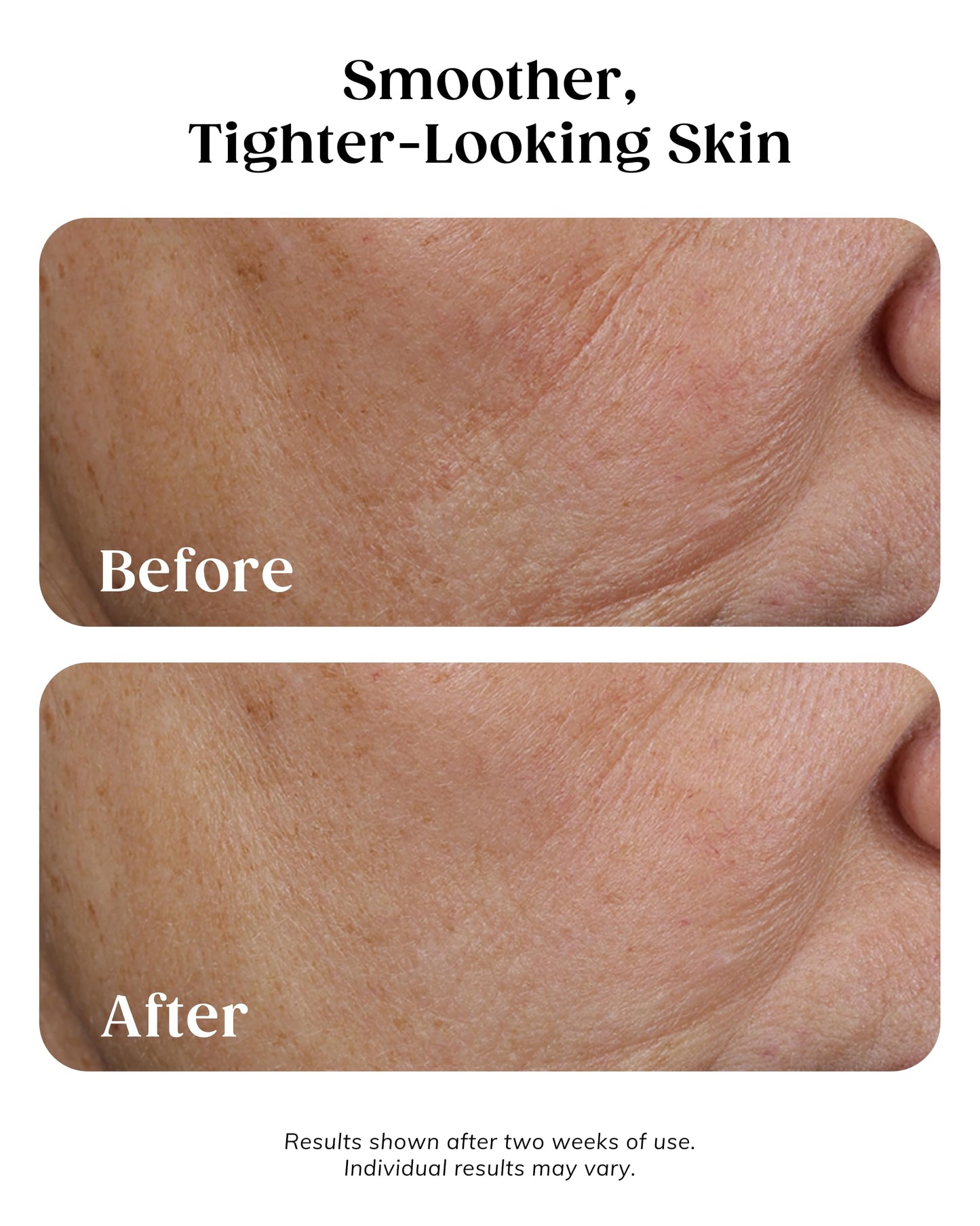KAPLAN MD Retinol Serum for Face - 3% Active Retinol Diamond Contour 1-Minute Skin Tightening Concentrate & Collagen Pro-Peptide Complex for Smoother, Younger-Looking Skin - Dermatologist-Developed