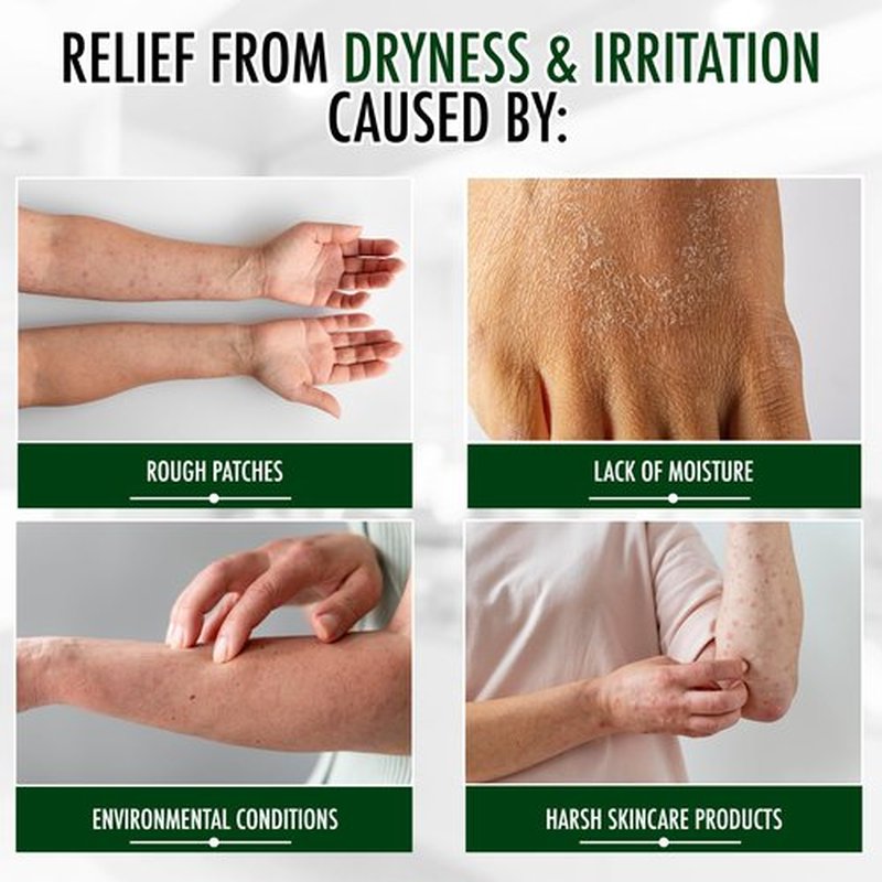 GLY MIRACLE Moisturizing Body Cream for Extremely Dry Skin, Non- Greasy Skin Humectant for Hands, Body & Feet, Body Lotion for Extremely Dry Skin, Non-Oily Fragrance Free, with Pure Glycerin, 12 Ounce