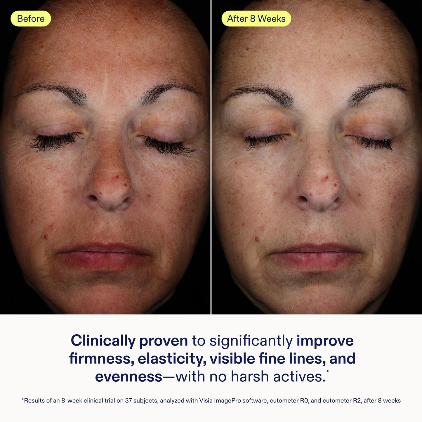 Skinfix Exo + Ectoin Intensive Repair Baume - 1 oz - Retinol-Free Face Serum with Hyaluronic Acid, Peptides - Visibly Smooths Wrinkles, Evens Dark Spots & Redness - Fragrance Free, Vegan, Cruelty Free