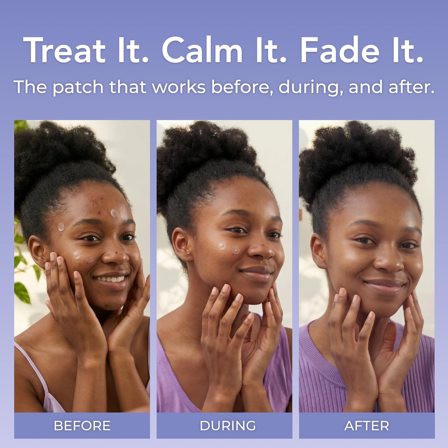 Pimple Patches with Retinol (120 Patches), Hydrocolloid Acne Patches with Tea Tree Oil for Face, Pimple Patch Pimple Stickers - Hydrocolloid Patch Acne Dots - Acne Pimple Patches For Face