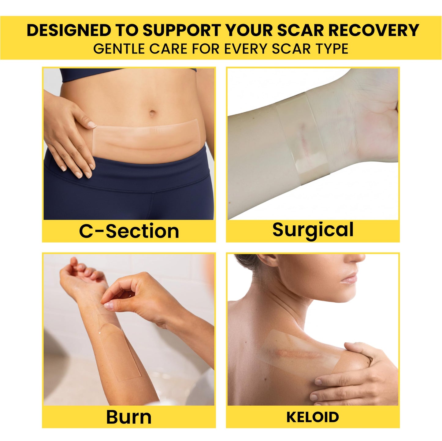 Scar Bandit Silicone Scar Sheets for C-Section & Surgical Scars – Silicone Scar Tape for C-Section Recovery After Birth, Tummy Tuck & Surgery – Flexible Scar Sheets for Keloid & Scar Care - 4 pcs
