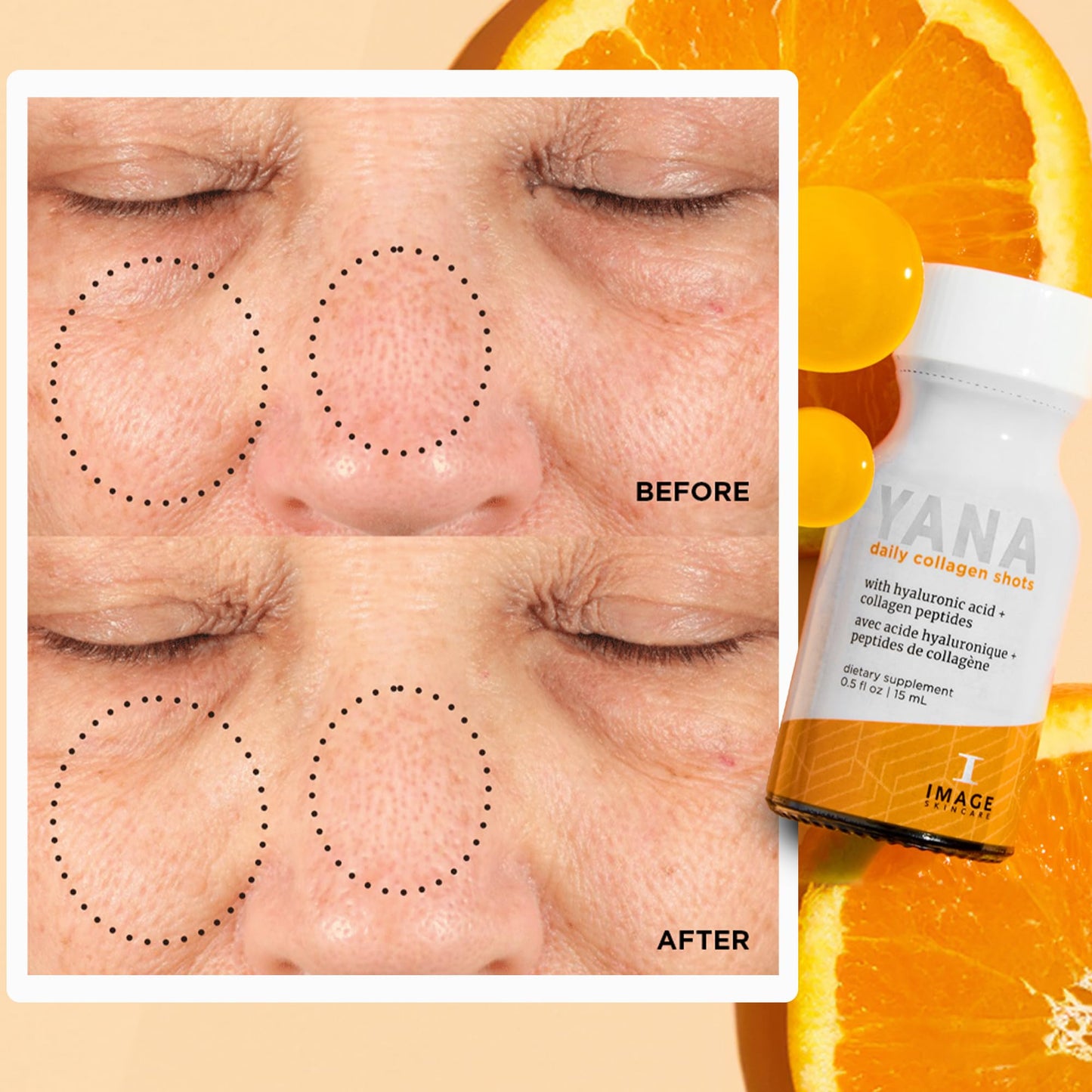 IMAGE Skincare, YANA Liquid Collagen Shots, 2500 mg Hydrolyzed Bovine Collagen Peptide Supplement with Biotin, Natural Citrus Flavor, 28 Daily Shots