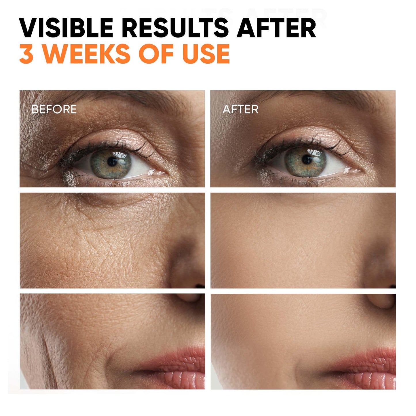 EVERYOUTH Vitamin C Serum with Retinol & Hyaluronic Acid