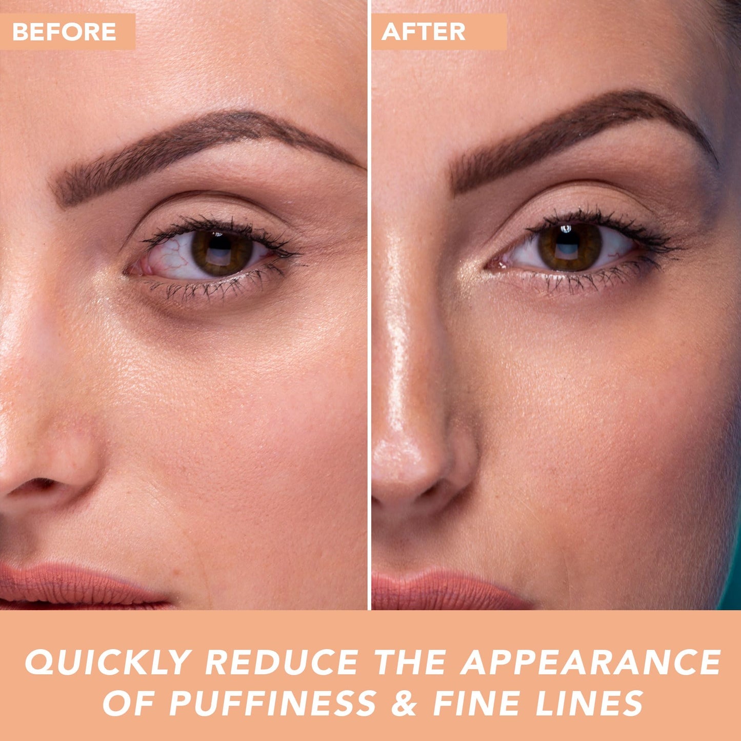 Under Eye Cream - Cooling Hyaluronic Acid Eye Gel for Dark Circles