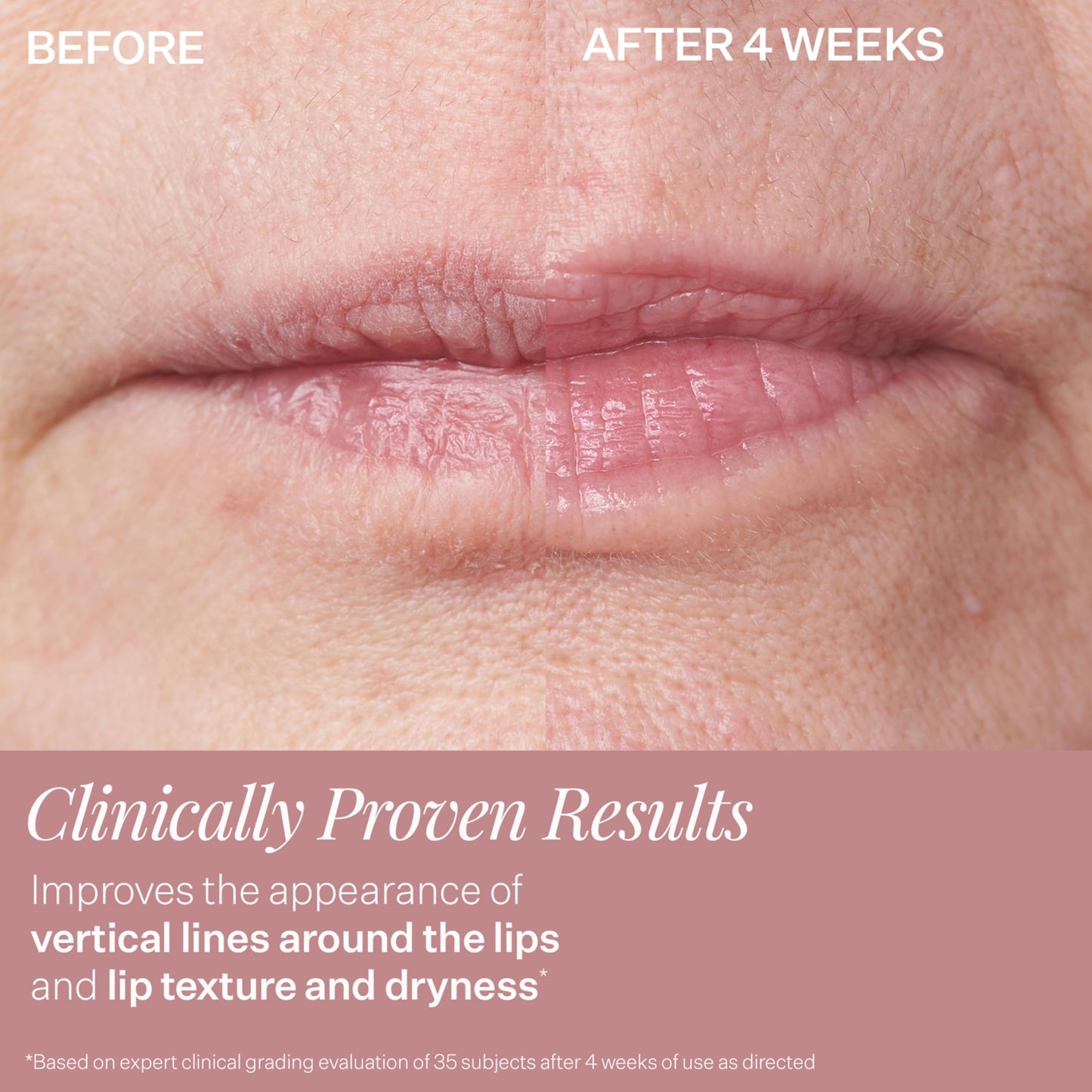 StriVectin DoubleFix For Lips 2-in-1 Lip Fix Plumping Treatment & Vertical Line Treatment (Pack of 2)
