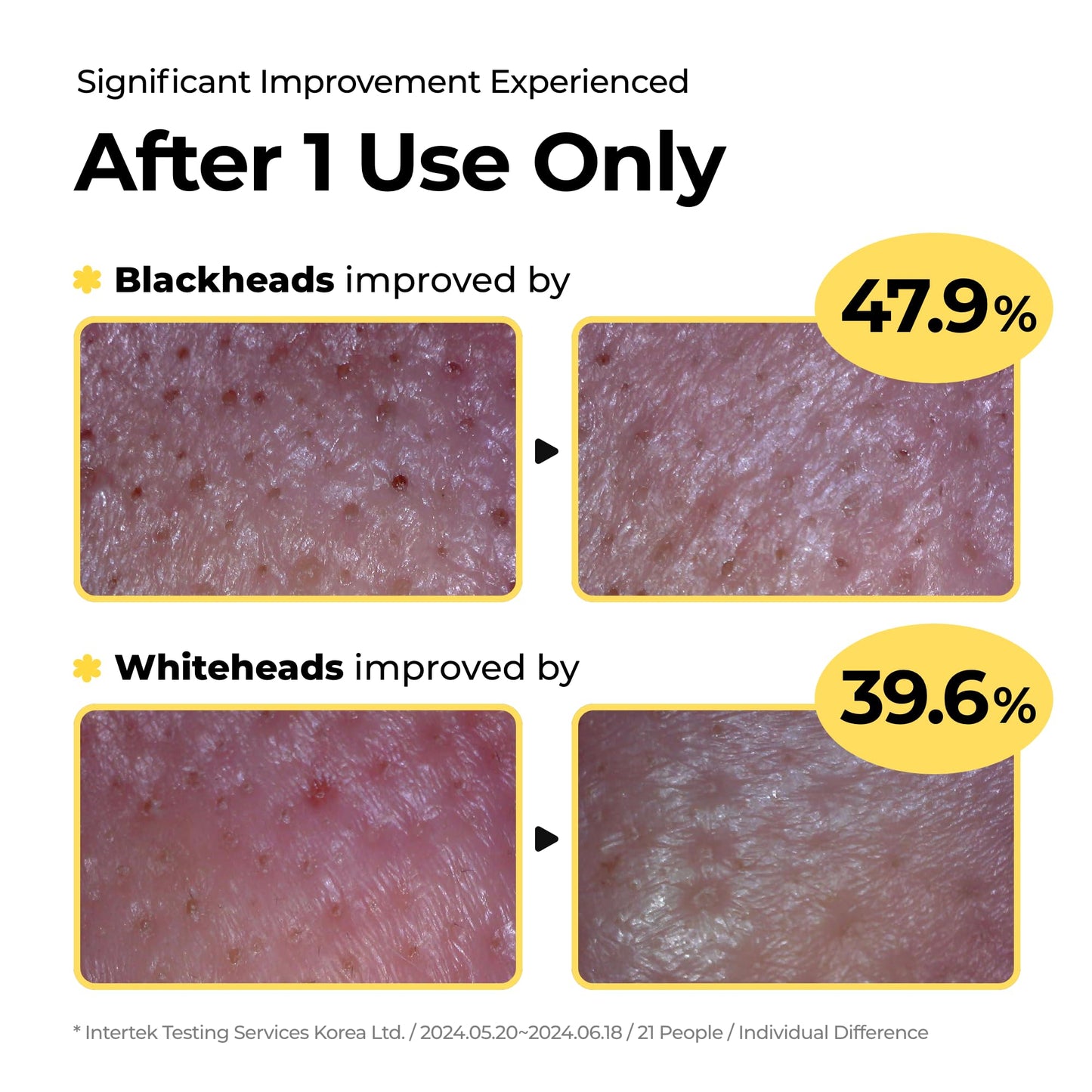 SINSURU Sulfur Mineral Cleansing Powder, Exfoliating Facial Wash with Enzymes and PHA for pores and blackheads, Even Skin Tone, Radiant, Sensitive, Acne-Prone Skin, Korean Skincare(1.76 oz. 50g)