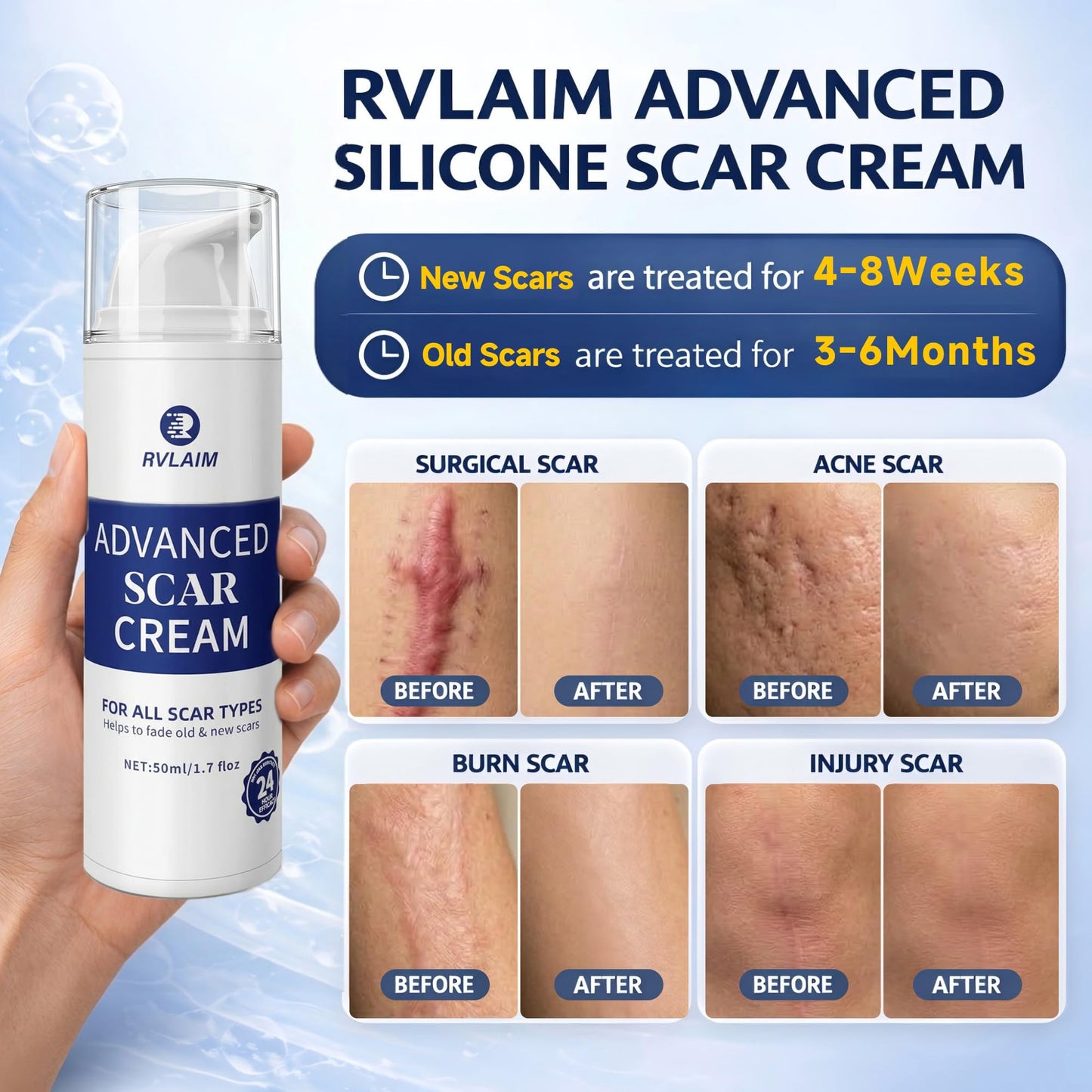 Scar Cream Scar Gel, Advanced Silicone Scar Gel, Professional Scar Removal Cream for Surgical Scars, Stretch Mark, Keloid Bump, C-Section, Old and New Scars