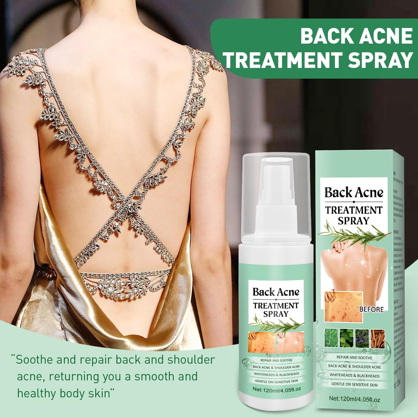 Back Acne Treatment Spray With Herbal Formula, 2% Salicylic Acid & Tea Tree Oil - Body Acne Solution, 120ml