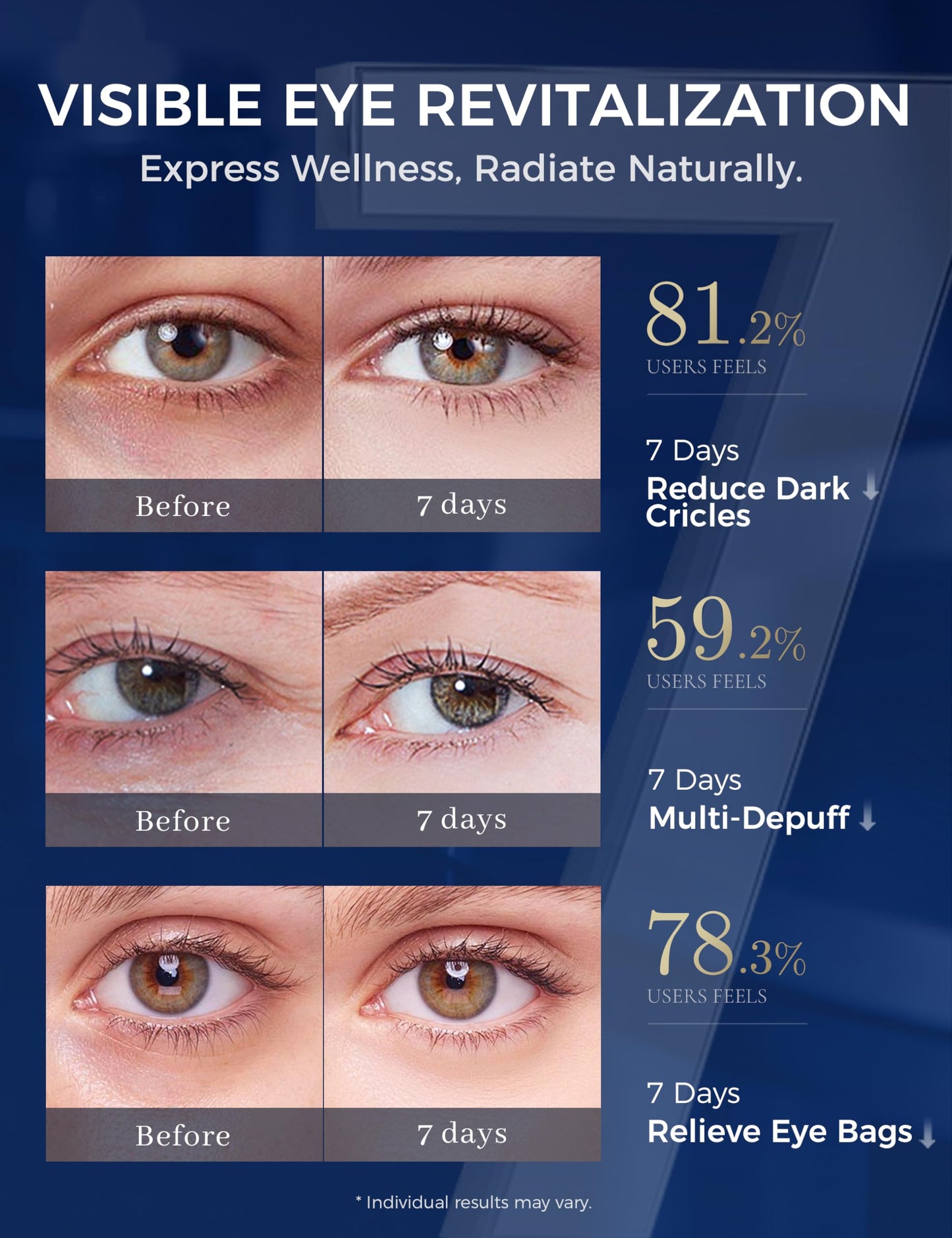 EXPRESSIONS WELLNESS Retinol Eye Cream for Dark Circles with Caffeine Peptides Niacinamide Tranexamic Acid, Under Eye Cream for Puffiness and Eye Bags, Hydrating Firming Korean Eye Care 1.06 oz Silver