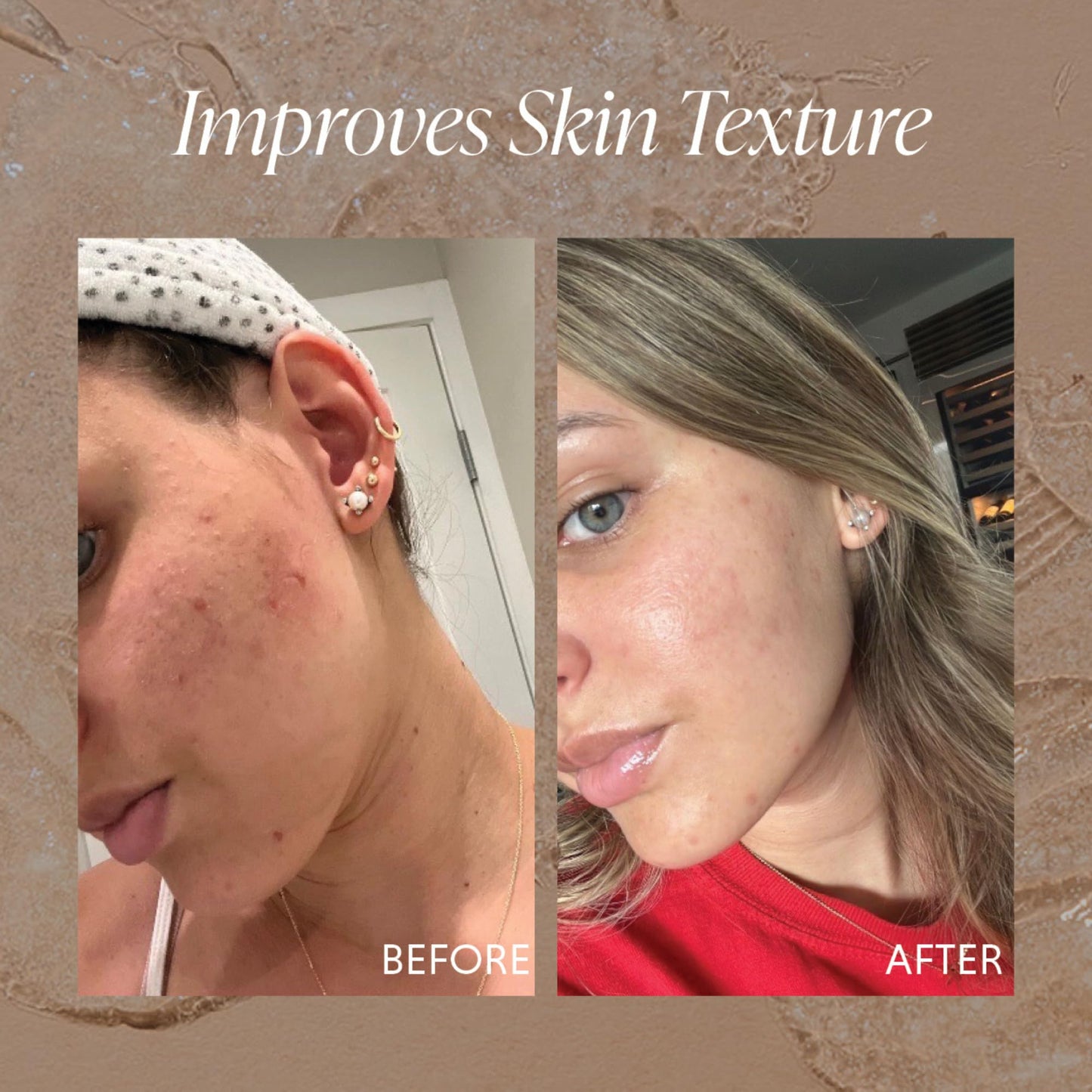 The Daily Essential Exfoliating Face Gel W/Jojoba Oil, Salicylic Acid, Glycolic Acid & More | For Dead Skin, Unclog Pores, Remove Dead Skin, Smooth Skin Bumps Co (Exfoliant)